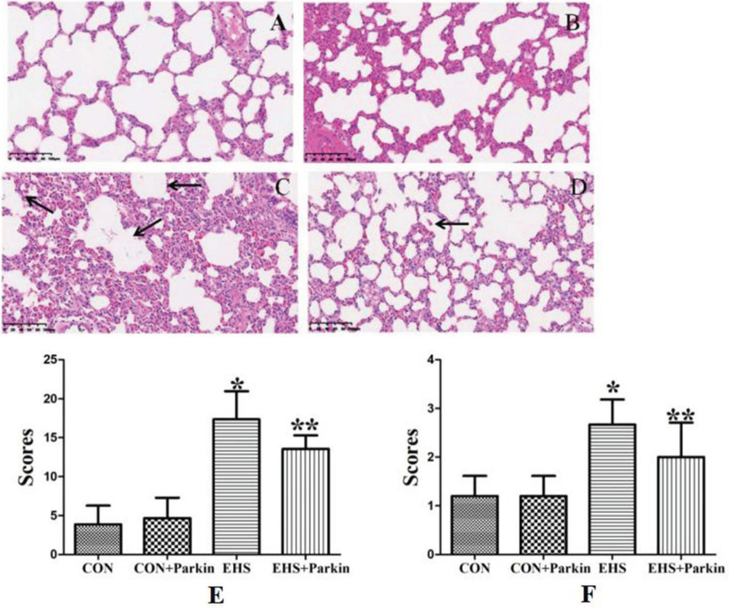 The Parkin over-expression rats resist the HS-induced pathological changes of the lung (N = 5). A: CON group; B: CON + Parkin group; C: EHS group; D: EHS + Parkin group. Arrows indicate edema. E: The histologic scoring of lung injury; F: The histologic scoring of lung edema.