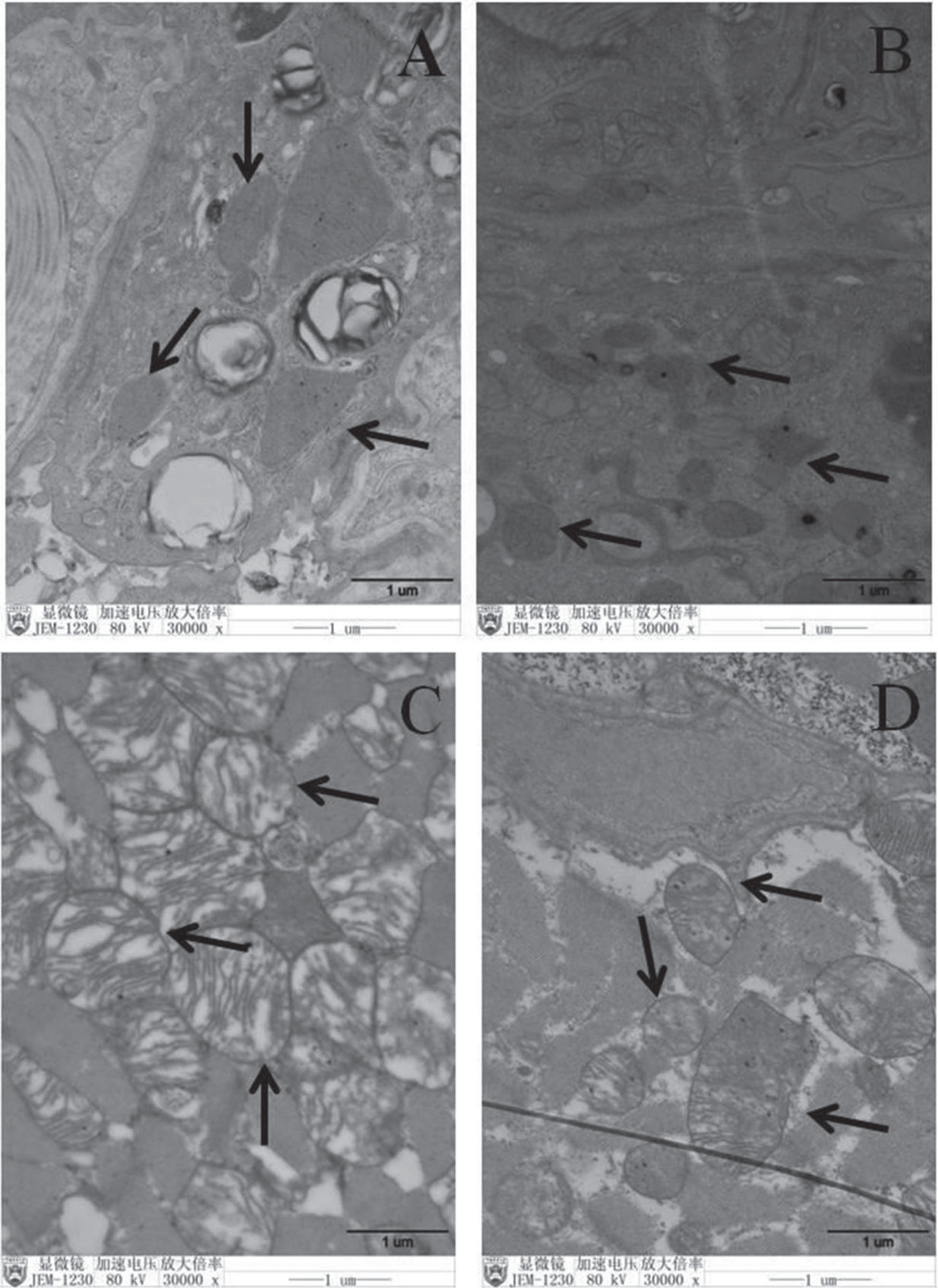 Pulmonary mitochondrial injury was attenuated to a greater extent morphologically in HS + Parkin group rats. A: CON group; B: CON + Parkin group; C: EHS group; D: EHS + Parkin group. Arrows indicate mitochondrion.