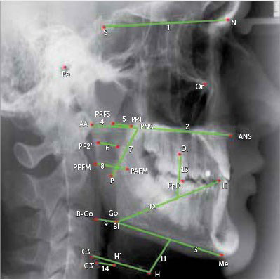 Example of cephalometric X-ray image with landmarks [11].
