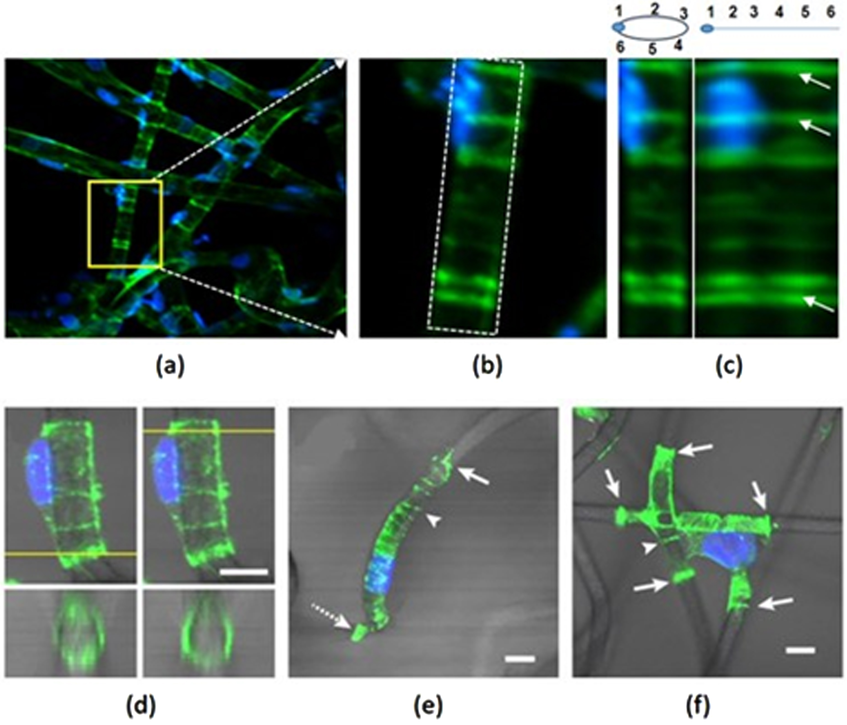 Visualization of circular gripping of SMFs by F-actin in the human umbilical vein ECs (HUVECs) (Reproduced from [1]). (a)-(c) visualized F-actin in the HUVECS. (a) An original confocal image in 2D projection. A SMF portion containing F-actin bands of interest is marked by a yellow rectangle; (b) An enlarged image of the yellow rectangle in (a); (c) Left shows a vertically oriented image projection of (b). For comparison, we unwrapped the cylinder distribution of F-action to visualize full-circle continuity of F-actin around the SMF (right). Fig (d)-(f) are examples of F-actin rings in the interaction between a cell and a scaffold(s). (d) Full-wrapping of a fiber at the cell’s extremities (yellow line) by F-action bundles. The white scale is around 10μm; (e) F-actin in a SMF-attached cell. It contains AGs (arrowhead), an actin ruffle-like structure (arrow), and a blob with abundant actin (dashed arrow); (f) A cell is laid over three intertwining SMFs. The concentration of AGs is greater at all extremities than at the interior of the cell(arrowhead).