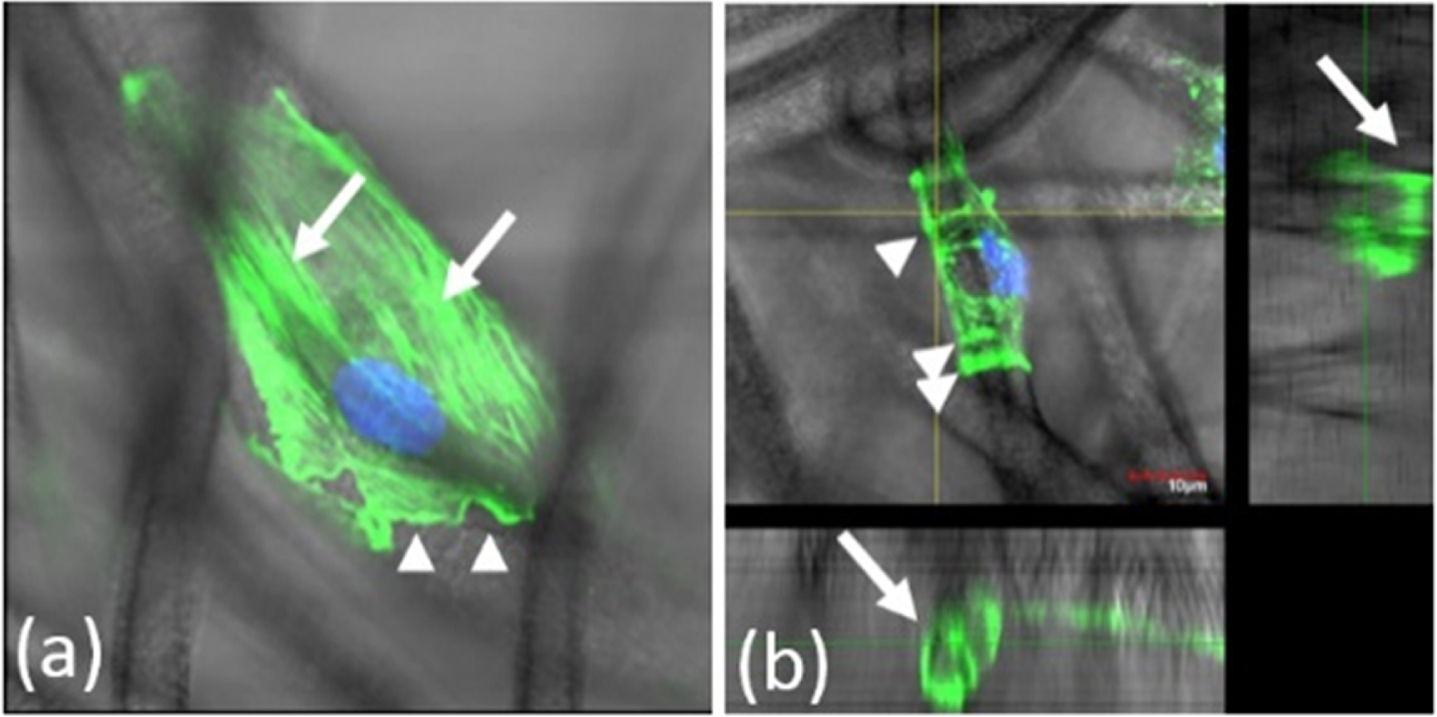 F-actin organization in cell-scaffold interaction. (a) An image of longitudinally aligned stress fibers (arrows). The arrowheads indicate F-actin containing ruffles. (b). A cross-sectional image of a supporting fiber. Concave actin bundles (CABs) (arrow) grip the fiber in a circular fashion. Green indicates F-actin. Blue indicates the nuclei.