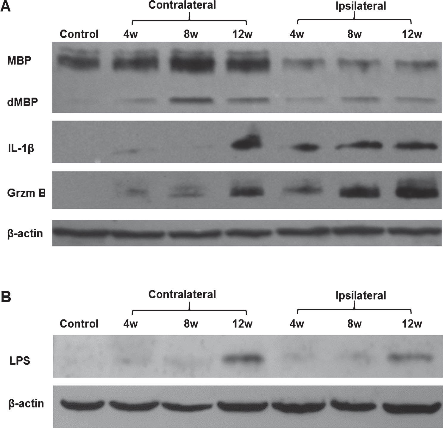 Western blot analysis of brain samples of animals subjected to lipopolysaccharide /ischemia /hypoxia (LPS/IS/H). Animals were subjected to LPS/IS/H and sacrificed 4 weeks, 8 weeks, and 12 weeks later. Naïve animals were used as control. One animal in each time point was examined. The cortex, basal ganglia, and hippocampus ipsilateral to the focal ischemia and contralateral to the ischemia were taken for Western blotting. A) Staining of brain samples was performed using antibodies to myelin basic protein (MBP), interleukin-1β (IL-1β), and Granzyme B (Grzm B). Note decreased MBP in the ipsilateral hemisphere compared to control and contralateral hemisphere; appearance of degraded MBP (dMBP) in the ipsilateral and contralateral hemisphere; and the gradual induction of both IL-1β and Grzm B in the ipsilateral and contralateral hemisphere from 4 to 12 weeks after LPS/IS/H. β-actin was used as the loading control. B) LPS (MW ∼30 kDa) was detected on Western blot analysis in cortex ipsilateral and contralateral to the focal cerebral ischemia at 4 weeks, 8 weeks, and 12 weeks after the LPS/IS/H. Note increased LPS at 12 weeks compared to that at 4 or 8 weeks. LPS was absent in control brain. β-actin was used as loading control, showing somewhat less loading in the 8 week samples.