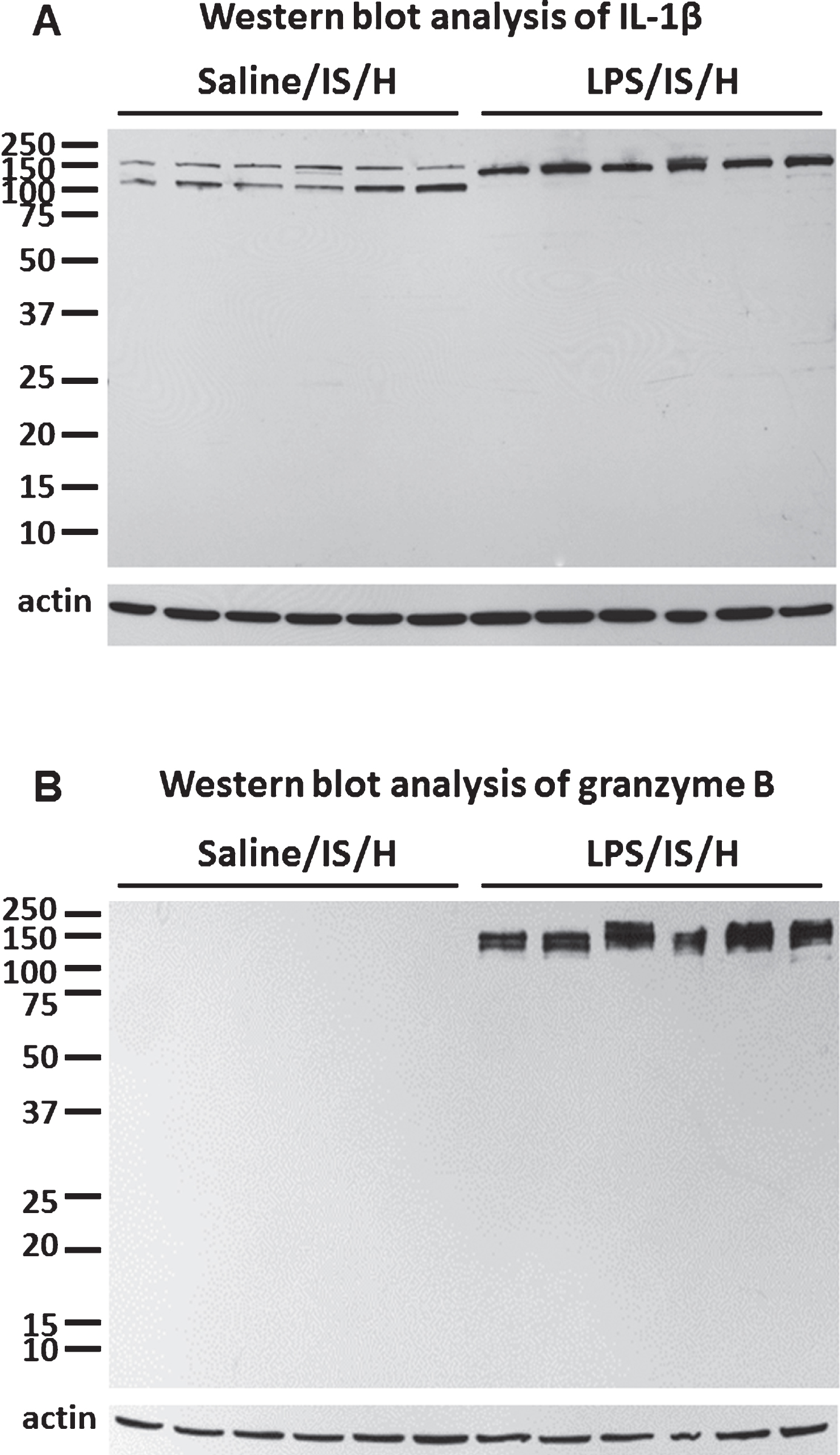 Western blot analysis for IL-1β and granzyme B in the cortex ipsilateral to ischemia at 12 weeks following LPS/IS/H and saline/IS/H. A) Interleukin-1β (IL-1β) was induced after saline/IS/H and LPS/IS/H. Note that two bands of proteins (around 150 kDa and 120 kDa) were detected following saline/IS/H and only one protein band (around 140 kDa) was detected following LPS/IS/H. B) Granzyme B was not detectable following saline/IS/H but was markedly induced after LPS/IS/H. β-actin was used as the loading control.