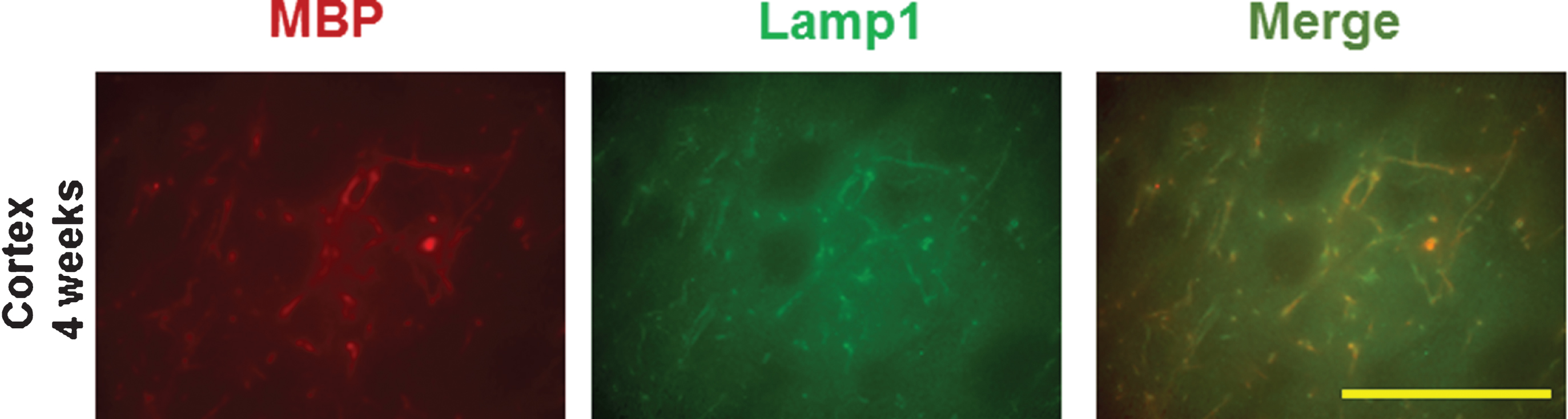 Double staining of myelin basic protein (MBP) with lysosomal-associated membrane protein 1 (Lamp1) in the cortex following LPS/IS/H. At 4 weeks post LPS/IS/H, focal areas of Lamp1 immunostaining and MBP immunostaining were co-localized (Merge). Bar = 50 μm.