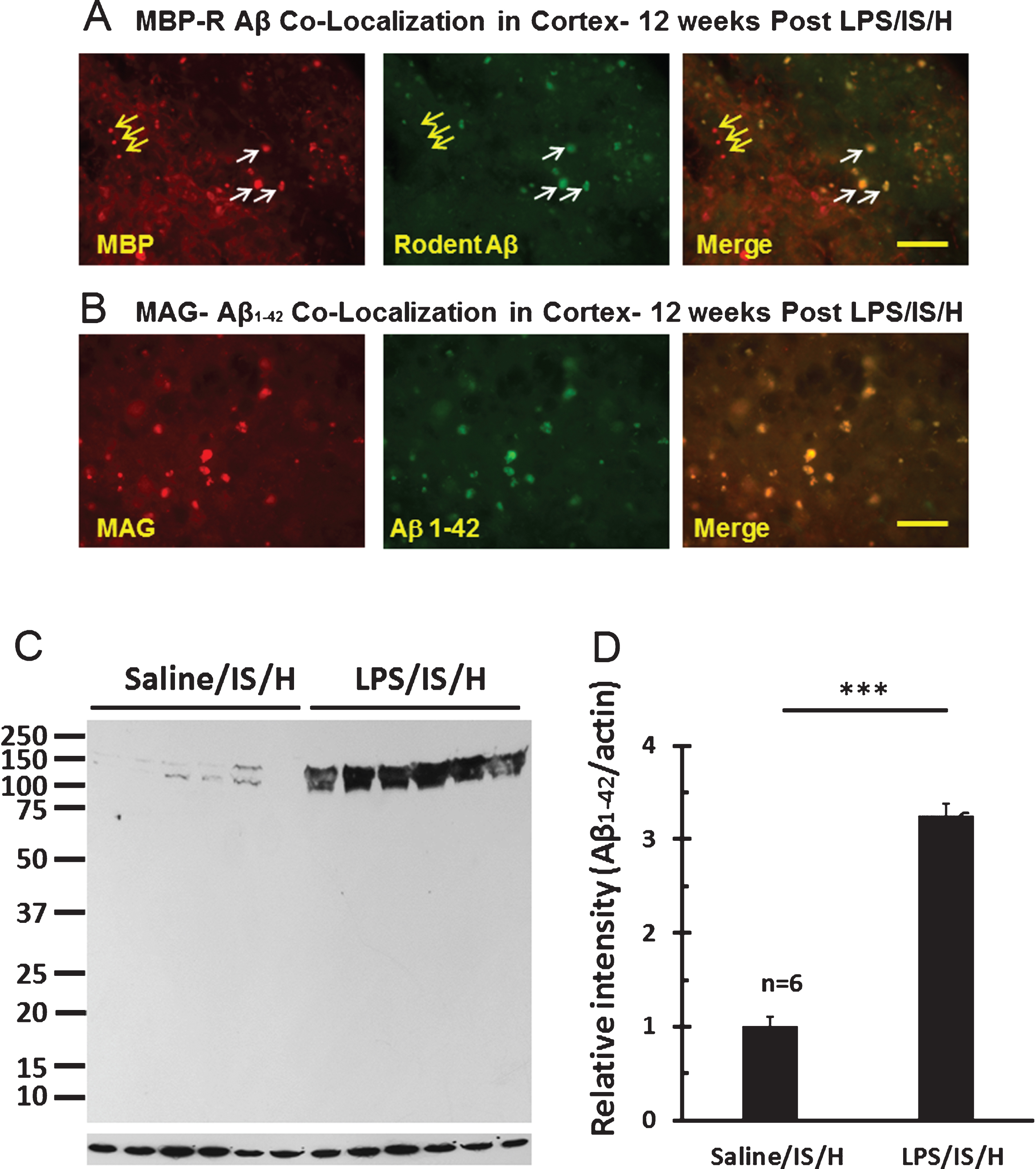 Co-localization of myelin aggregates with rodent Aβ and Aβ1 - 42 expression in the hemisphere ipsilateral to ischemia at 12 weeks following LPS/IS/H. A) Myelin aggregates stained with myelin basic protein (MBP) co-localized with rodent Aβ (R Aβ) deposits. Most of the MBP stained foci co-localized with rodent Aβ (white arrows, Merge) whereas some did not (yellow arrows). R Aβ likely represents AβPP. B) Myelin associated glycoprotein (MAG) co-localized with Aβ1 - 42 deposits. MAG immunostained foci in cortex co-localized with Aβ1 - 42 (B, Merge). Bars = 50 μm. C) Western blot analysis for Aβ1 - 42 at 12 weeks following saline/IS/H and LPS/IS/H. Two bands of ∼150 kDa and ∼140 kDa were detected on Western blots using the Aβ1 - 42 antibody which showed marked induction of both bands following LPS/IS/H compared to saline/IS/H. D) Quantification of the expression of Aβ1 - 42 showed that it markedly increased following LPS/IS/H compared to that following saline/IS/H.  **p <  0.01.