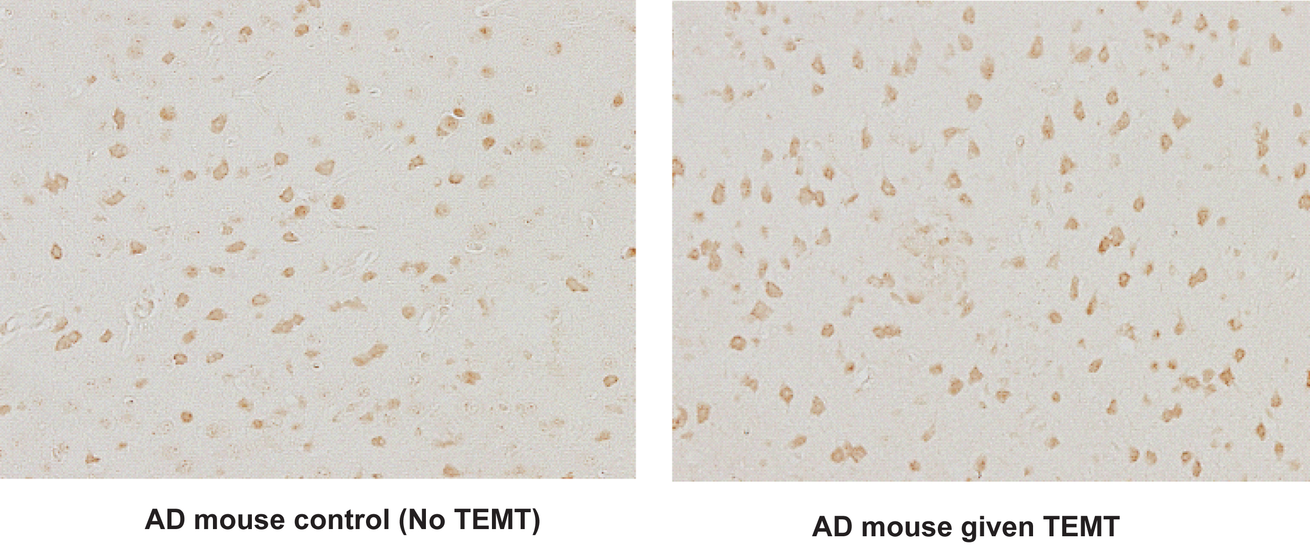 TEMT increases neuronal activity in entorhinal cortex of aged AD mice, as indicated by the number of cFos-stained neurons. Note increased number of active neurons in AD mice given long-term TEMT (right) compared to control AD mice not given TEMT (left). For AD and normal mice, average number of c-Fos-stained neurons in entorhinal cortex from five representative fields increased from 83 neurons per field in controls to 100 neurons per field after TEMT (↑21%; p < 0.02).