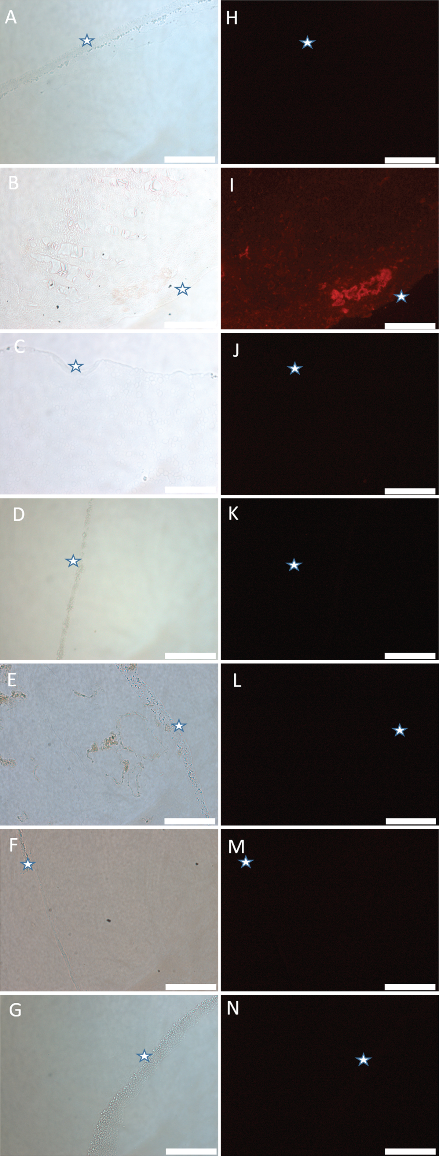 Light and fluorescence images of metal-impregnated agarose blocks stained with lumogallion. A, H) agarose gel only; B, I) agarose gel + Al(III); C, J) agarose gel + Ca(II); D, K) agarose gel + Cu(II); E, L) agarose gel + Fe(III); F, M) agarose gel + Mg(II); G, N) agarose gel + Zn(II). Stars indicate equivalent areas of each agarose block. Scale bar is 50 μm.