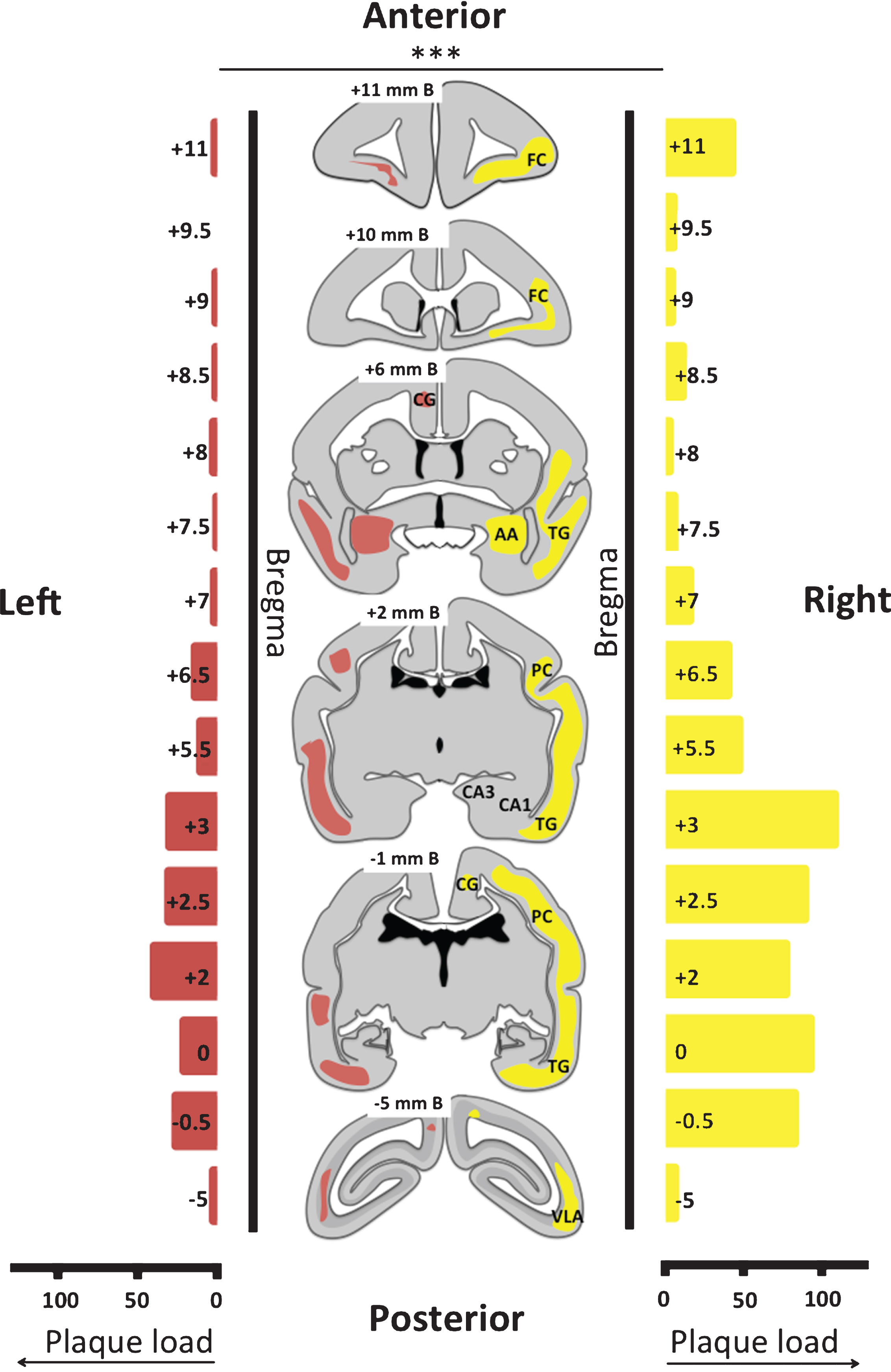 Plaque load and distribution throughout brain of monkey m9856. The distribution of the plaques is visualized on six transcranial sections and indicated in yellow in the right hemisphere and in red in the left hemisphere. The absolute plaque load of the right and left hemisphere on the sections analyzed are displayed on the left and the right side, respectively. The right demonstrated significantly more severe amyloidopathy than the left hemisphere (p < 0.001; Wilcoxon-signed-rank test). B, Bregma; FC, frontal cortex; CG, cingulate gyrus; AA, anterior amygdala; TG, temporal gyrus; PC, posterior cortex; CA3 & CA1, regions of hippocampus; VLA, ventrolateral anteriorextrastriate area.