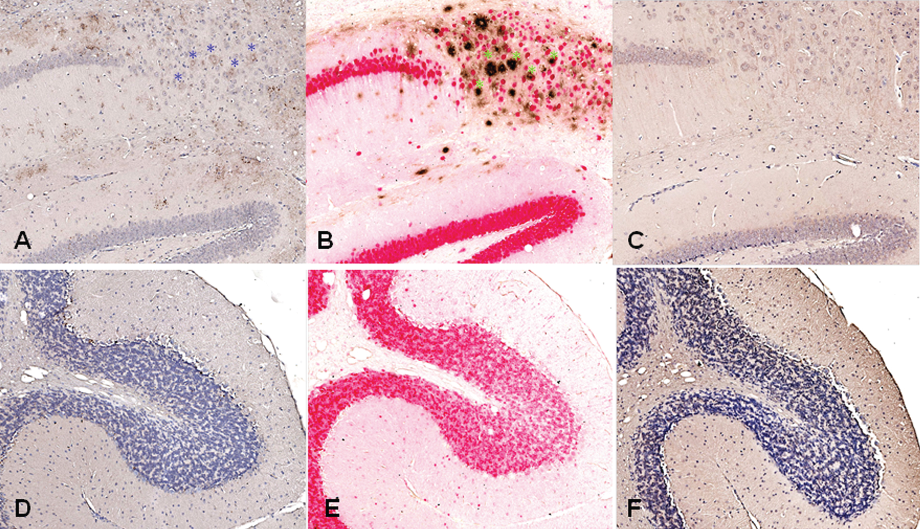 Antibodies from DNA Aβ42 immunized rabbits stain amyloid plaques in brain of 3xTg-AD mice (24 months old mouse). A) Aβ staining in hippocampus area with plasma from rabbit 828D (brown), B) control staining in parallel section with commercial anti-Aβ42 antibody (McSA1, brown) and NeuN (red), C) control staining of brain section from this 3xTg-AD mouse with control serum from a non-immunized rabbit, D–F) show no staining with rabbit antiserum and commercial antibody in plaque free cerebellum. In all sections, a 10x magnification is shown (Hamamatzu Nanozoomer). Asterisks indicate plaques stained with rabbit plasma (in A, blue in the color version online and black in the print version) and commercial control antibody (in B, green in the color version online and black in the print version).