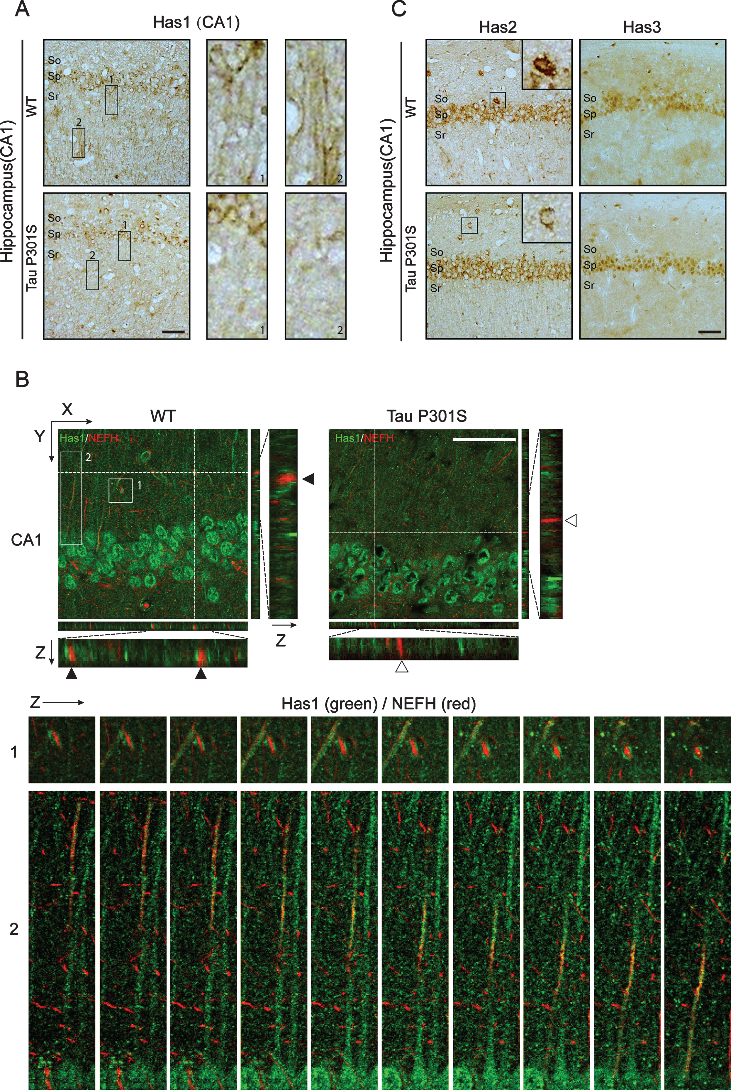 TauP301S expression inhibits the axonal-localization of Has1 in hippocampus. A, B) Immunohistochemical analyses (A) and immunofluorescence images (B) revealing the expressions and the distribution of Has1 in CA1 of the wild-type (WT) and TauP301S Tg (Tau P301S) mice (10-month-old). The enlarged regions of A showing the axonal-localization of Has1 in WT and TauP301S Tg mice. The lower panels of B are the enlarge Z section images of box 1 and 2 in the upper panel, showing the relative localization of Has1 (green) and NEFH (red) in the stratum radiatum of hippocampus. Scale bar = 50μm. C) Immunohistochemical analyses revealing the expressions of Has2 and Has3 in CA1 of WT and TauP301S Tg mice. Scale bar = 50μm.