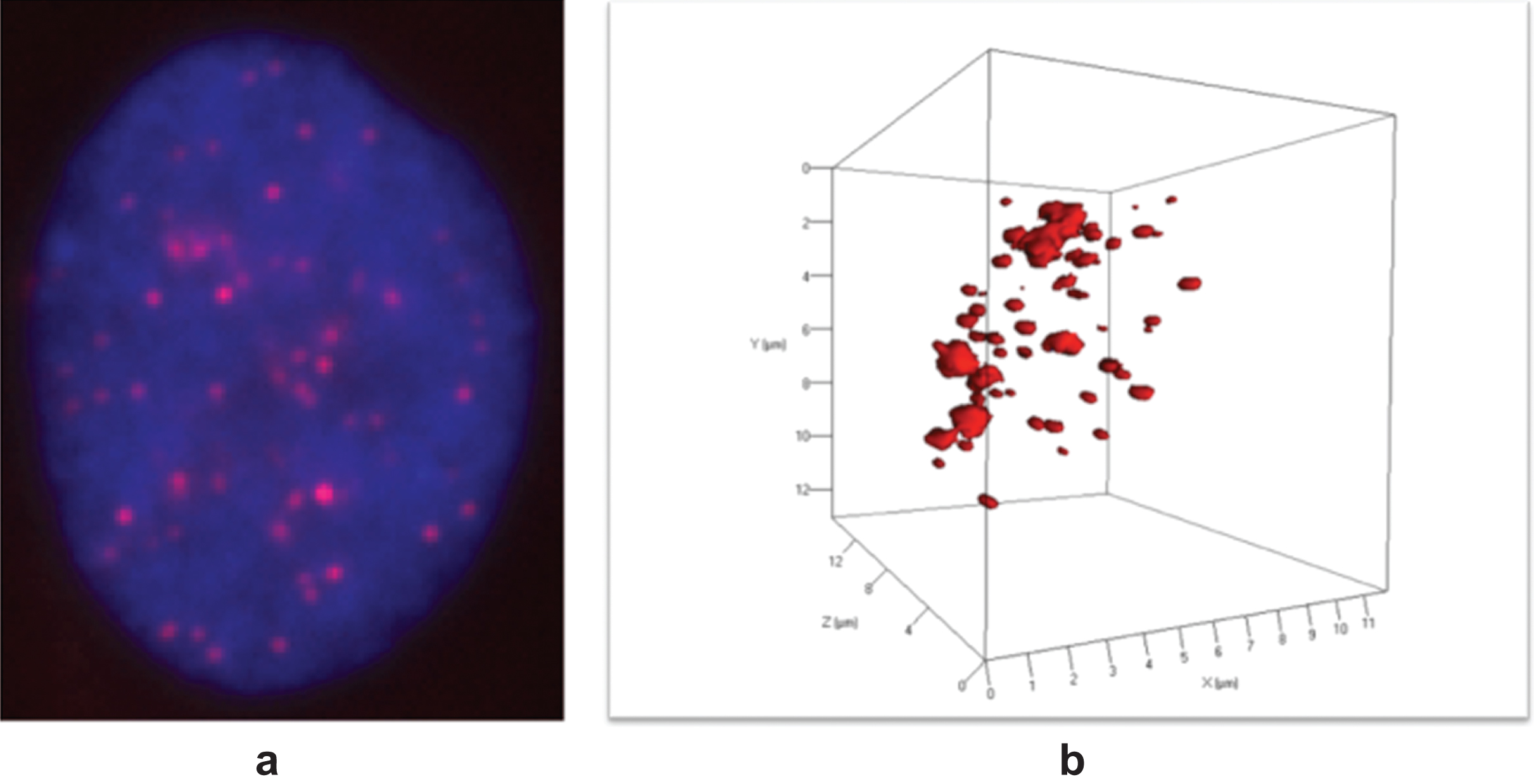 Representative two (2)- and three dimensional (3D) image of a buccal cell nucleus hybridized with a CY3-labled telomere probe (red) (Materials and Methods). (a) 2D image of nucleus hybridized with CY3-labled telomere probe (red). Nucleus (blue). (b) 3D image of the identical nucleus. Telomeres are shown in red. Disease progression and telomere images were illustrated in [36].