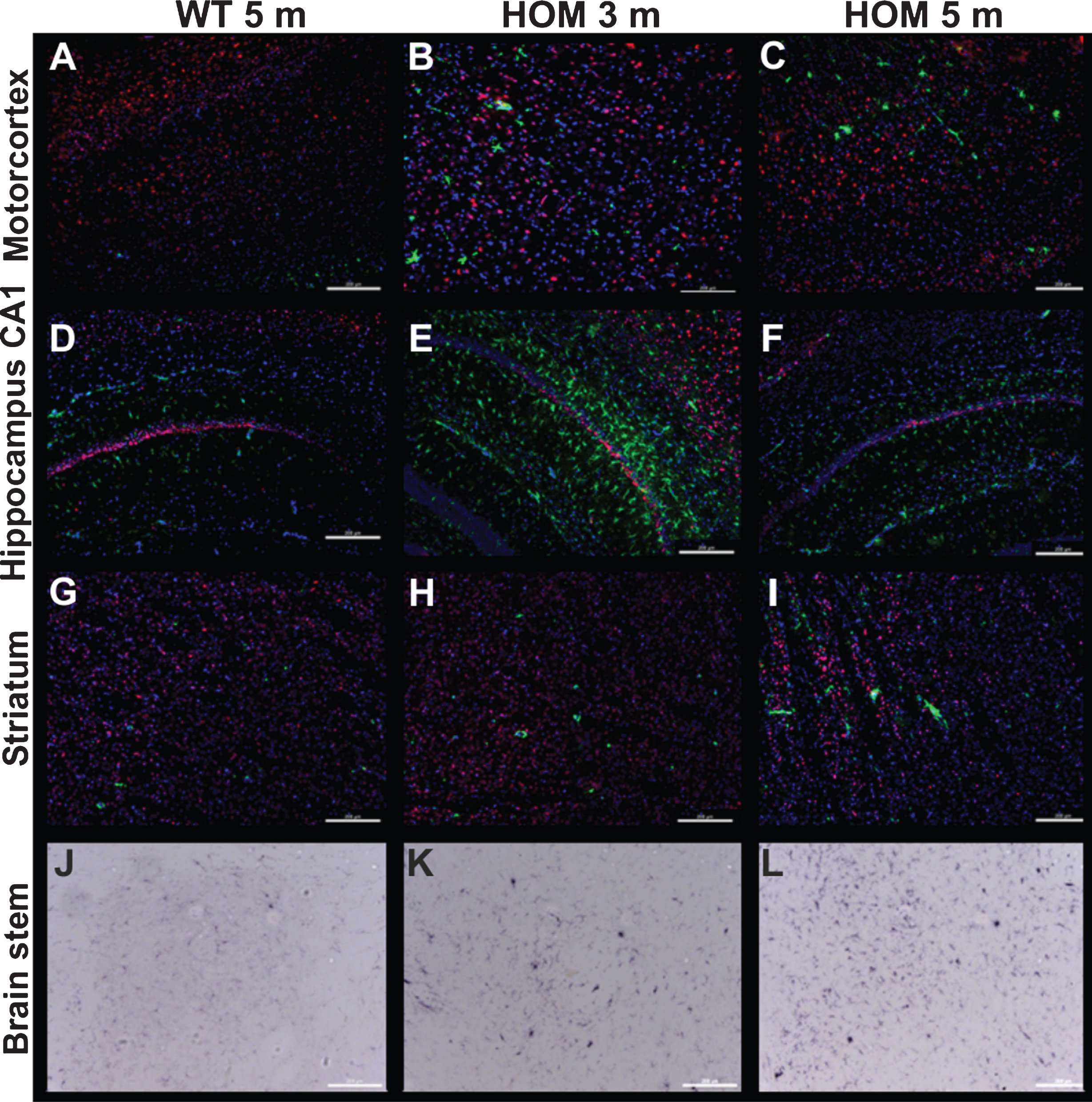 Gliosis and neuronal loss in homozygous TBA2.1 mice. Representative immunofluorescence and bright field images of the motorcortex, CA1 hippocampal region, striatum, and brain stem of a 5 months old wild type (WT), and 3 and 5 months old homozygous (HOM) mice illustrating activated astrocytes (GFAP, green, A-I), activated microglia (CD11b, bright field, J-K) and neuronal nuclei (NeuN, red, A-I). Counterstaining was performed with DAPI (A-I).