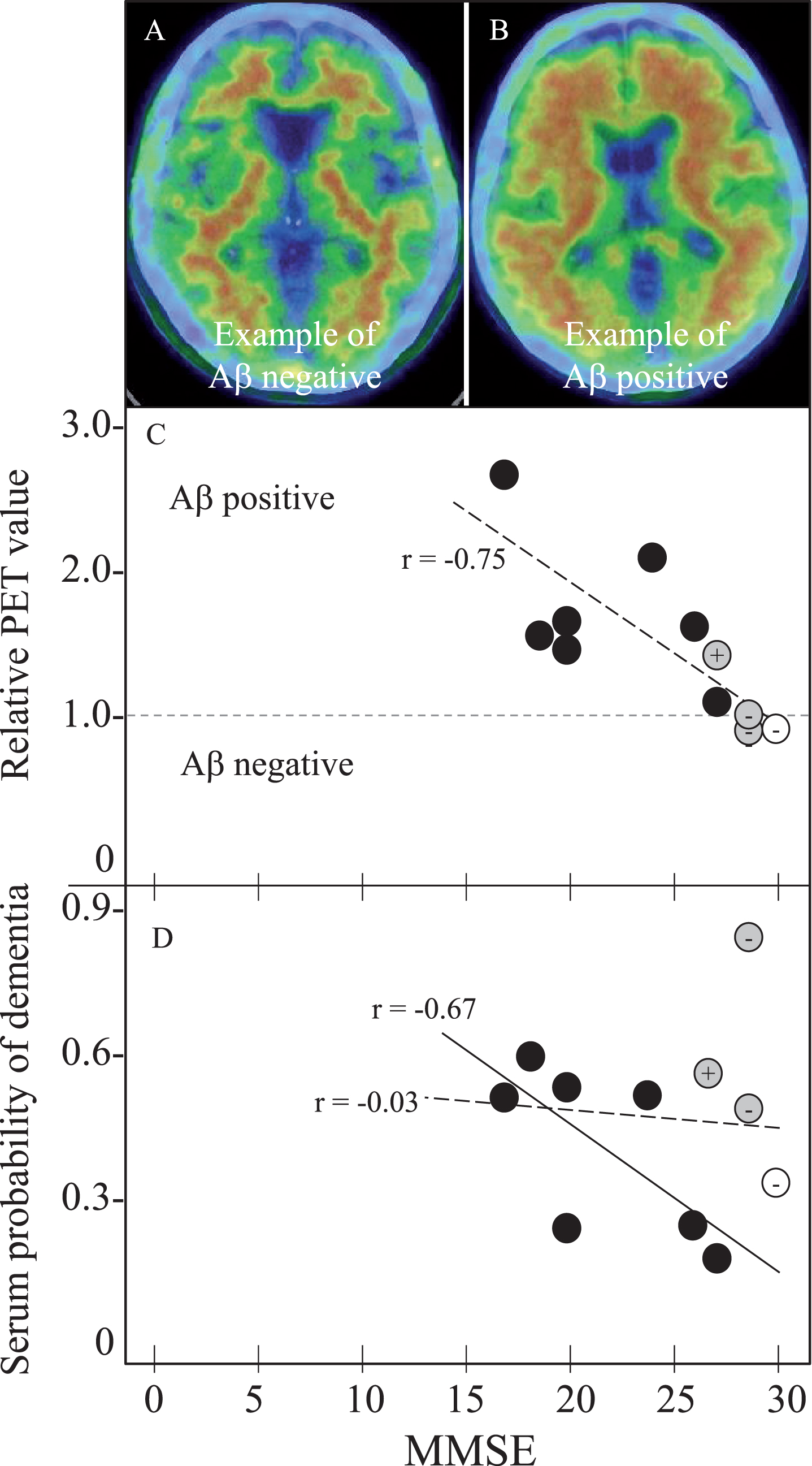 Amyloid PET and SPD with MMSE in 11 PET subjects for 1 NC, 3 MCI, and 7 AD. Panels A and B shows Aβ negative- and positive-example, (C) MMSE versus relative PET value of negative with 1 or less and positive with more than 1, and (D) MMSE versus SPD. Note the cortical Aβ deposit in PET-positive example (B), the strong correlation of relative PET value with MMSE in all 11 subjects (r = –0.75, p = 0.0070, panel C, oblique dotted line), and a significant correlation of SPD with MMSE in 7 AD patients (r = –0.67, p = 0.0908, panel D, oblique dotted line). Correlation coefficient of SPD versus MMSE was r = –0.03, p = 0.9198 for all 11 subjects (D, dotted line). Open circle represents NC, grey MCI, and black AD. + or – of grey MCI and control are Aβ-PET positive or negative, respectively.