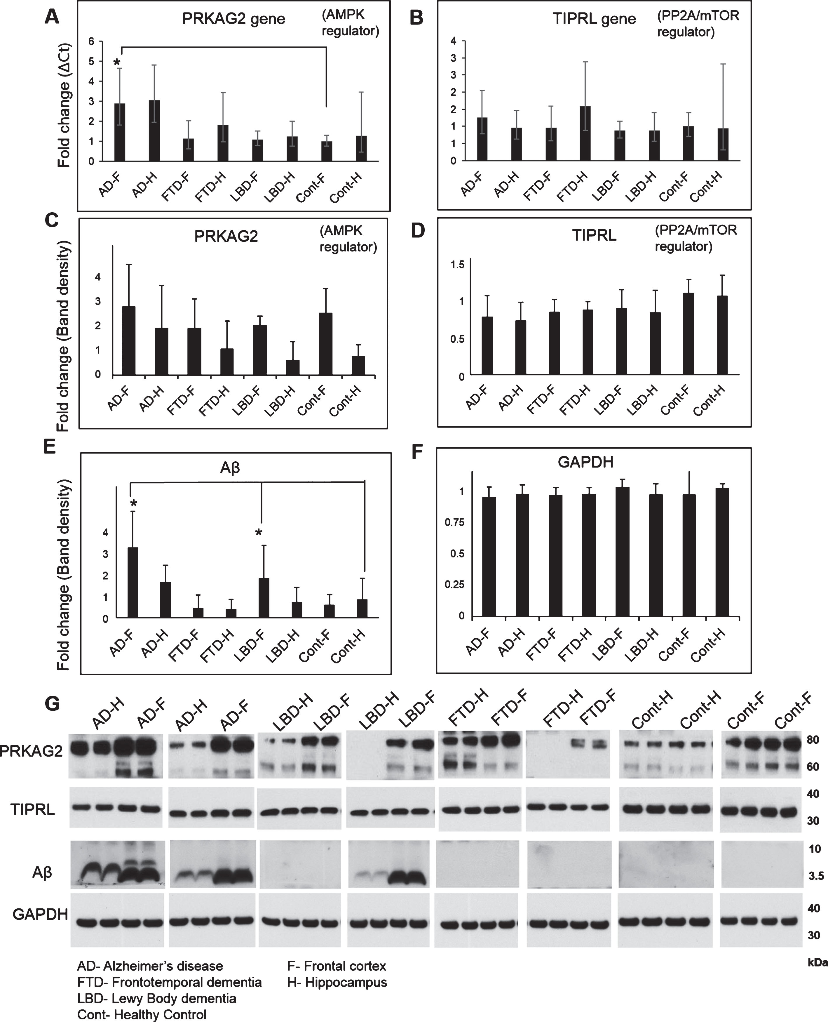 Gene and protein expression of autophagy regulators PRKAG2, TIPRL, and Aβ in AD, FTD, LBD, and control brains. Gene expression of autophagy regulators PRKAG2 (Hs00211903_m1), TIPRL (Hs00295580_m1), and endogenous control GAPDH (Hs03929097_g1) was conducted on cDNA synthesized from homogenates of frontal cortex (F) and hippocampus (H) regions of postmortem brain tissues from AD, LBD, FTD, and healthy controls (Cont) using Taqman assays on the QuantStudio 12K system. Fold change in gene transcripts of PRKAG2 (A) and TIPRL (B) was measured using comparative Ct method with GAPDH as endogenous control and Cont-F as the reference biological group. A 3-fold increase in PRKAG2 transcripts was observed in AD-F as compared to FTD-F, LBD-F and Cont-F (Mean±SD, *p<0.05). No significant changes were observed in the expression of TIPRL between the different groups. Protein levels of PRKAG2 (C), TIPRL (D), Aβ (E), and GAPDH (F) was also measured using western blotting analysis of the brain homogenates. A representative image of the western blot is shown here (G). No significant change in levels of PRKAG2 (60 and 75 kDa isoforms) and TIPRL (32 kDa) were observed between the different groups. Aβ (4 kDa) was significantly higher in AD-F and LBD-F as compared to Cont-F (Mean±SD, *p < 0.05).