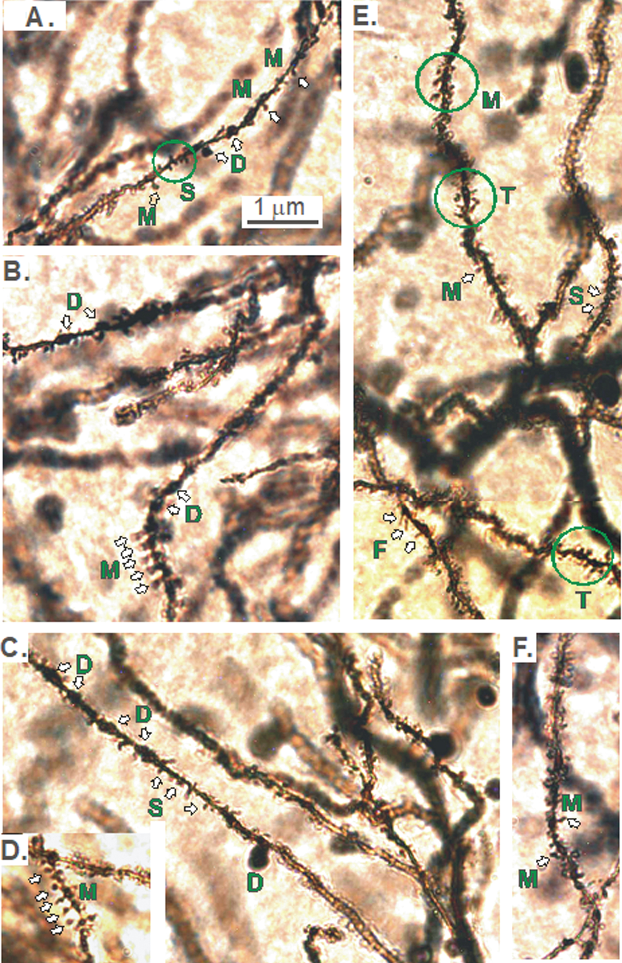 A-F). Different types of spines on dendrites originating from CA1 pyramidal cell bodies. The reduction in the dorsal CA1 region arborization in KO versus WT mice (Figs. 2–5) prompted the question of whether spine density was reduced and if so, were specific types of spines lost. Dendritic spines are most commonly mushroom-shaped (M). Other types are thin (T), filapodic (F), or stubby (S). The dendrite itself may also be dilated (D).