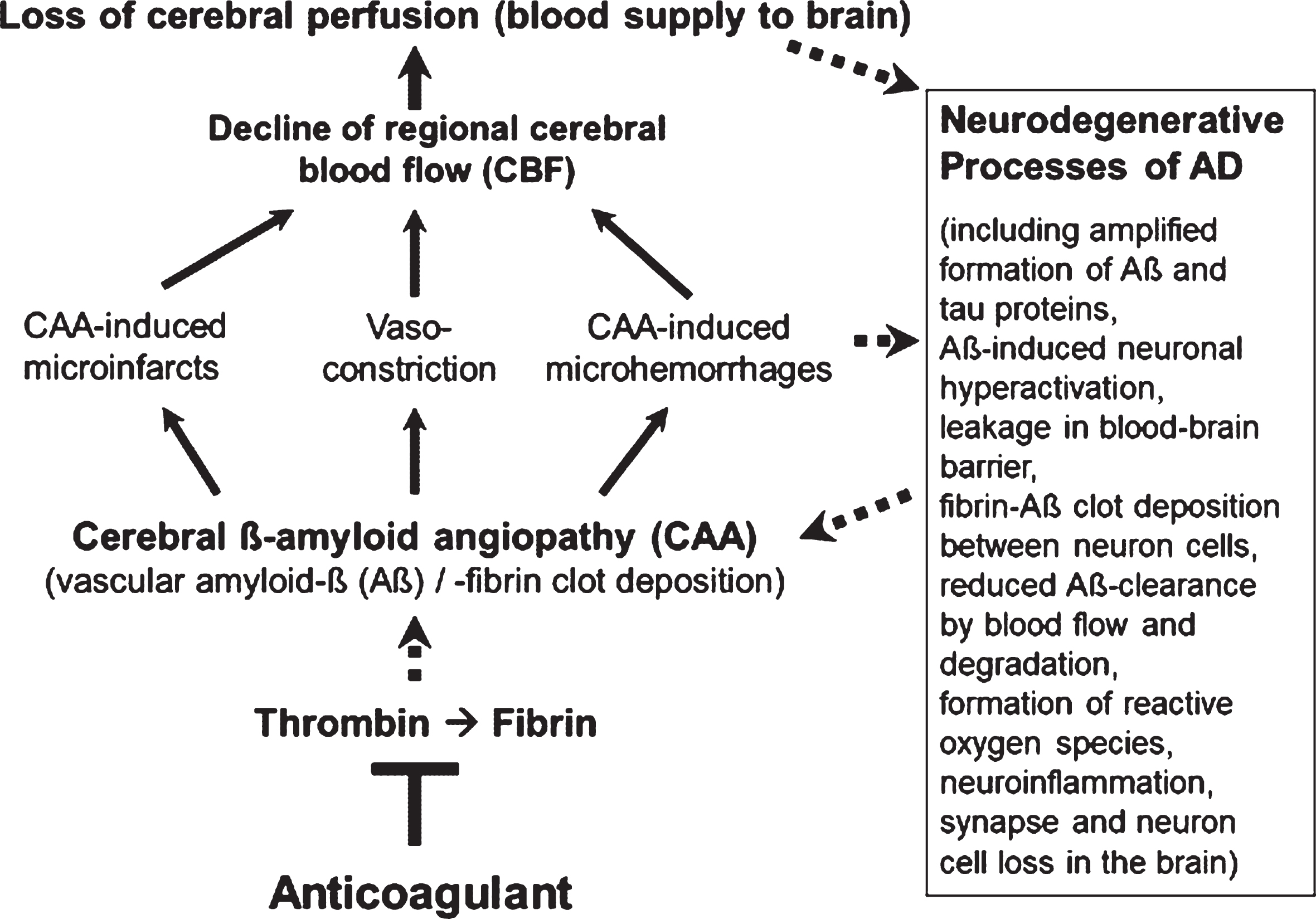 Vascular abnormalities, present in Alzheimer’s disease (AD), and proposed mechanism of action of direct oral anticoagulants (DOACs) for therapy. Typical of the early development of AD are pathological changes in the cerebral blood vessels, a condition, known as cerebral amyloid angiopathy (CAA). In the CAA, degradation-resistant fibrin clots containing amyloid-β-proteins (Aβ) deposit in and around cerebral blood vessels, leading to microvascular infarctions (occlusion), microhemorrhages and vasoconstriction of capillary vessels. Cerebral blood flow (CBF), mainly in neocortical and hippocampal areas, declines and brain perfusion and supply with oxygen and nutrients are lost. This amplifies neurodegenerative processes in the brain, exemplified by progressive Aβ and tau protein accumulation, reduced perivascular Aβ clearance, disruption of blood-brain barrier (BBB), neuroinflammation, and loss of synapses and neurons. In a kind of circulus vitiosus, vascular dysfunction and derived effects are steadily deteriorating. Anticoagulants inhibit thrombin and thus, the formation of fibrin at a central point of this process. Consequently, progressive fibrin-Aβ clot deposition in CAA and thrombin- and fibrin-induced inflammatory processes are blocked. Given full cerebral perfusion and reduced Aβ- and fibrin-accumulating and inflammatory milieu, it is proposed that anticoagulant treatment could be able to decrease vascular-driven progression in neurodegenerative and cognitive changes in AD. Indirect stimulatory effects are represented by dotted lines.