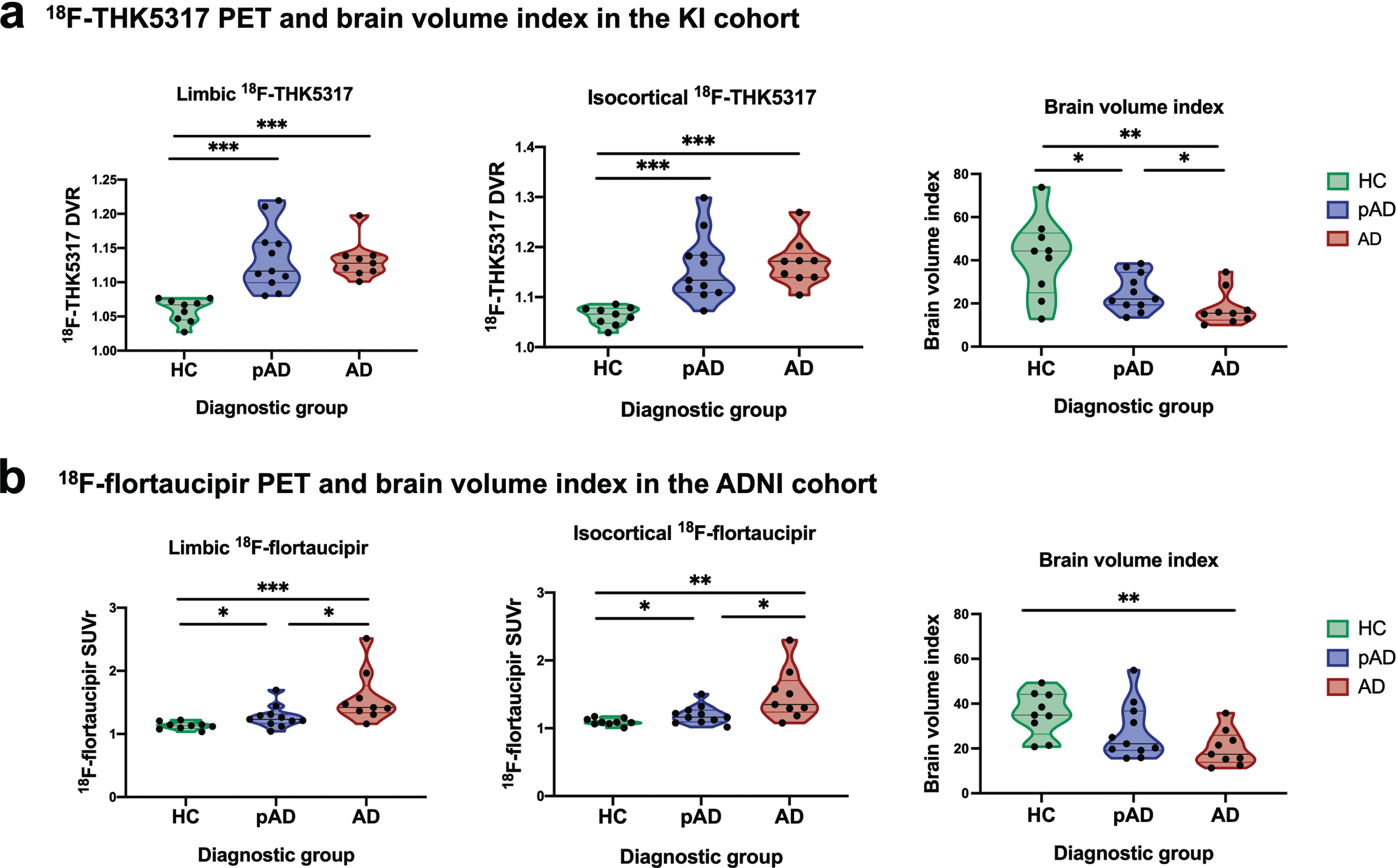 Violin plots illustrating patterns of tau PET uptake as measured by 18F-THK5317 and 18F-flortaucipir in the limbic and iscortical composite regions, as well as brain volume index across healthy controls, prodromal AD and AD dementia groups in the KI (a) and ADNI (b) cohorts. AD, Alzheimer’s disease dementia; DVR, distribution volume ratio; pAD, prodromal Alzheimer’s disease; SUVr, standardized uptake volume ratio. Statistical significance of discriminative ability as measured by receiver operating characteristic (ROC) area under the curve (AUC) analyses is indicated: *p < 0.05, **p < 0.01, ***p < 0.001.