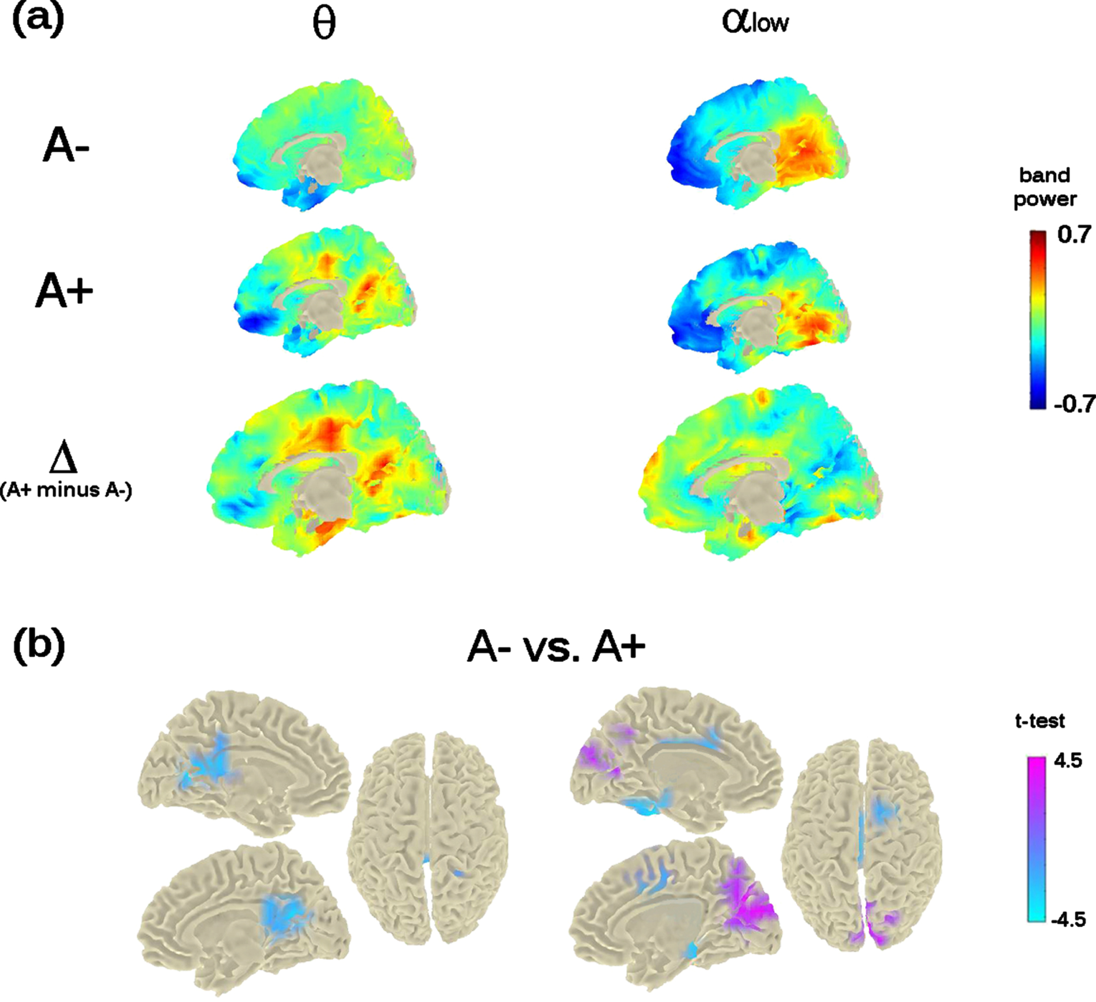 Theta- and Alpha-low band power distribution on the brain surface at the time of the second visit (i.e., M24). Panel (a) depicts the grand-mean across the whole sample for A– and A+ as well as the difference between A+ and A–. Power-values are expressed in z-scored as for M0. Panel (b) shows the independent-samples t-test computed between A– and A+. Negative t-test (in cyan) reflects ampler band-power for A+ with respect to A–; positive t-test (in magenta) reflects lower band-power for A+ with respect to A–. Importantly, significant probabilities are cluster-corrected for theta-band (left-column) and not at all corrected for alpha-low (right-column).