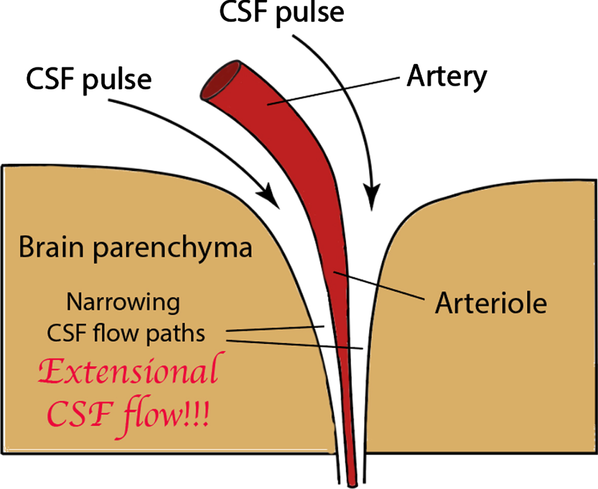 Virchow Robin space containing the CTE heavily pulsed CSF, rapidly flowing and narrowing perivascular CSF flow path that generates extensional flow that severely stretches dissolved Aβ and tau molecules and where the Aβ and tau can chemically combine into dimers that ultimately lead to tau seeds.