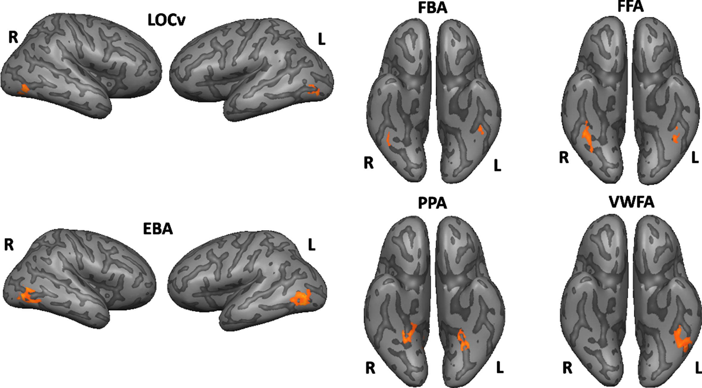 Functionally defined ROIs using subject-specific volume time courses (the surface maps are only for visualization purposes).