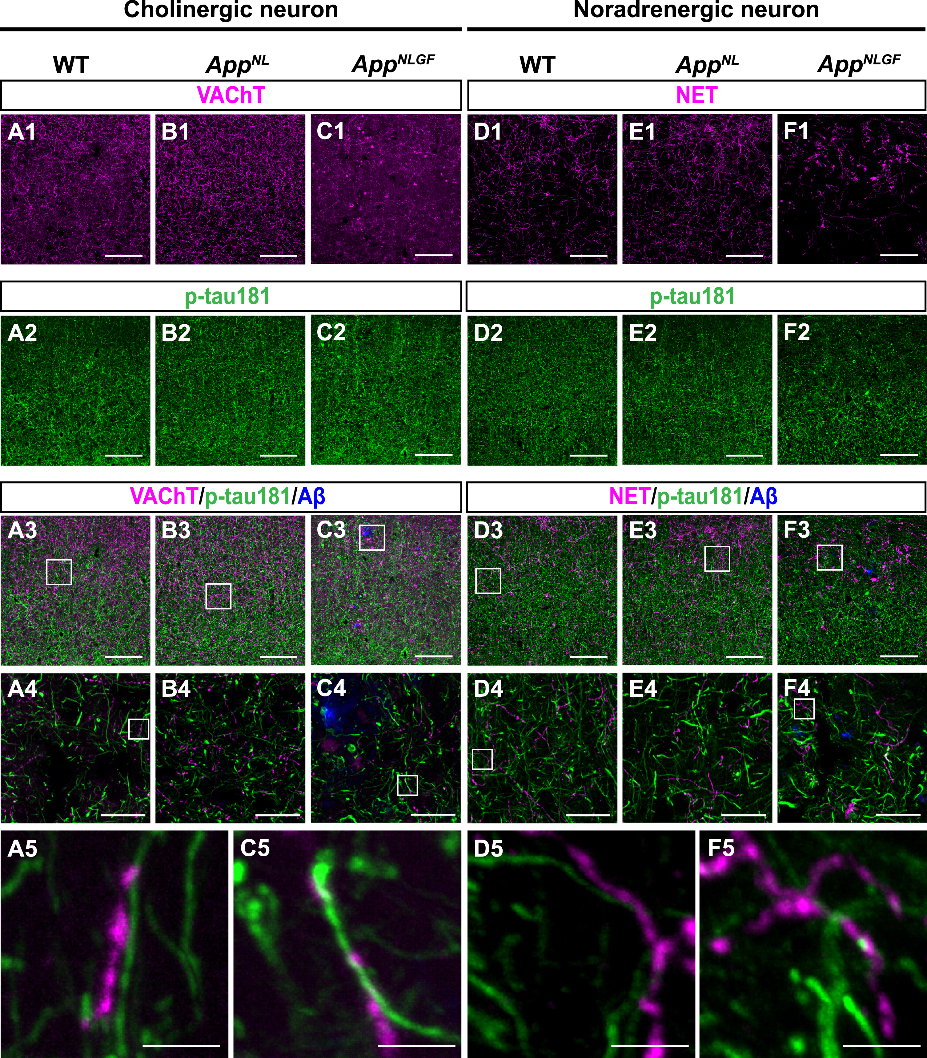 p-tau181-positive axons do not overlap with unmyelinated cholinergic or noradrenergic axons in mouse brains. Representative images of the cortex from frozen coronal brain sections immunostained with antibodies against VAChT (A1– C1; magenta in A3– C3), NET (D1– F1; magenta in D3– F3), and p-tau181 (A2– F2; green in A3– F3). FSB was used for detecting Aβ plaques (blue in A3– F3). Scale bars, 100μm. (A4– F4) Higher magnification of framed regions indicated in A3– F3. Scale bars, 20μm. (A5– F5) Higher magnification of framed regions indicated in A4 – F4. Scale bars, 2.5μm.