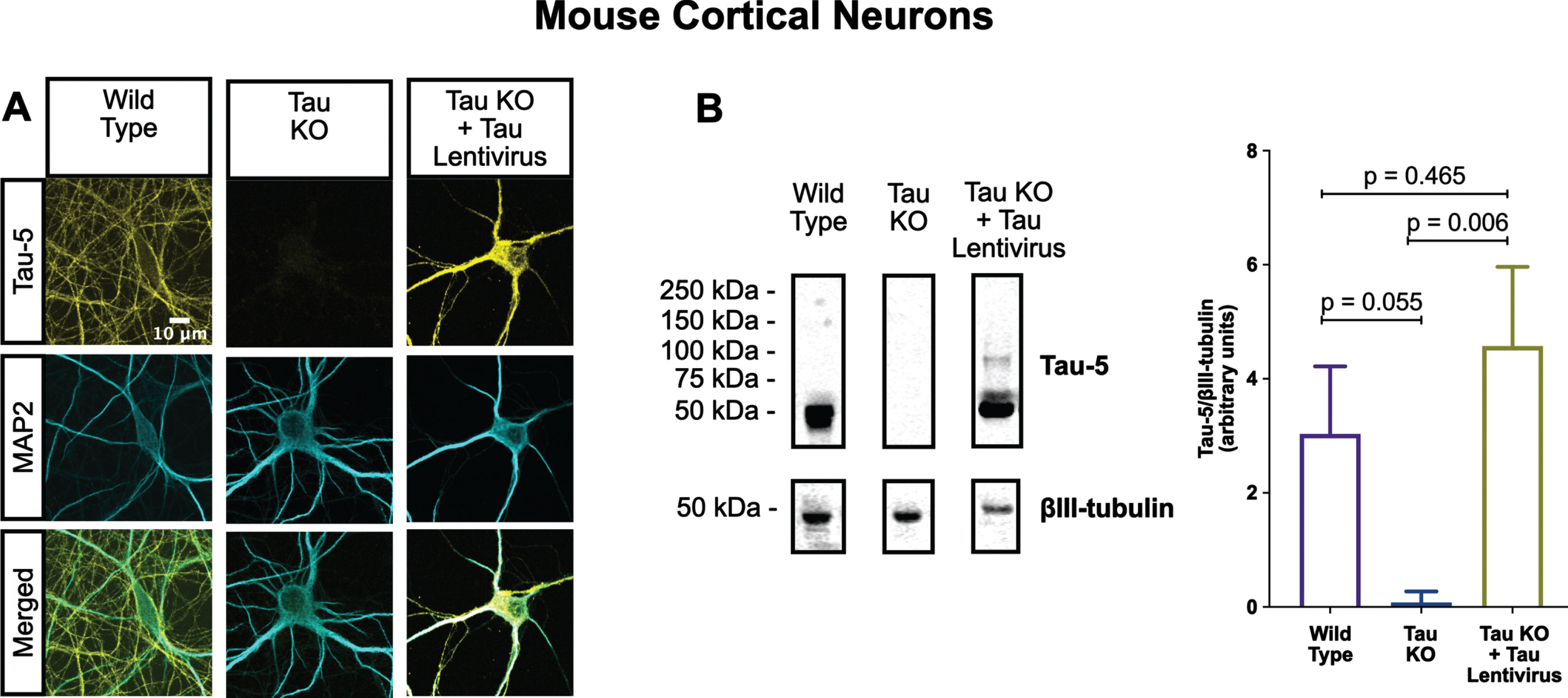 Lentiviral-encoded tau is expressed within normal levels in tau KO neurons. Shown here are detection of lentiviral-encoded human 2N4R tau in cultured tau KO neurons by immunofluorescence microscopy (A) and quantitative western blotting (B). Note that the average human tau expression level was ∼30% higher than the endogenous mouse tau expression level in cultured WT neurons, but the difference was not statistically different. Data were obtained from the following number of biological replicates: 3 for Wild Type, 6 for Tau KO and 3 for Tau KO + Tau Lentivirus. p-values are based on two-tailed unpaired t-tests, pooled variance. Error bars on the graph represent±standard error of the mean.