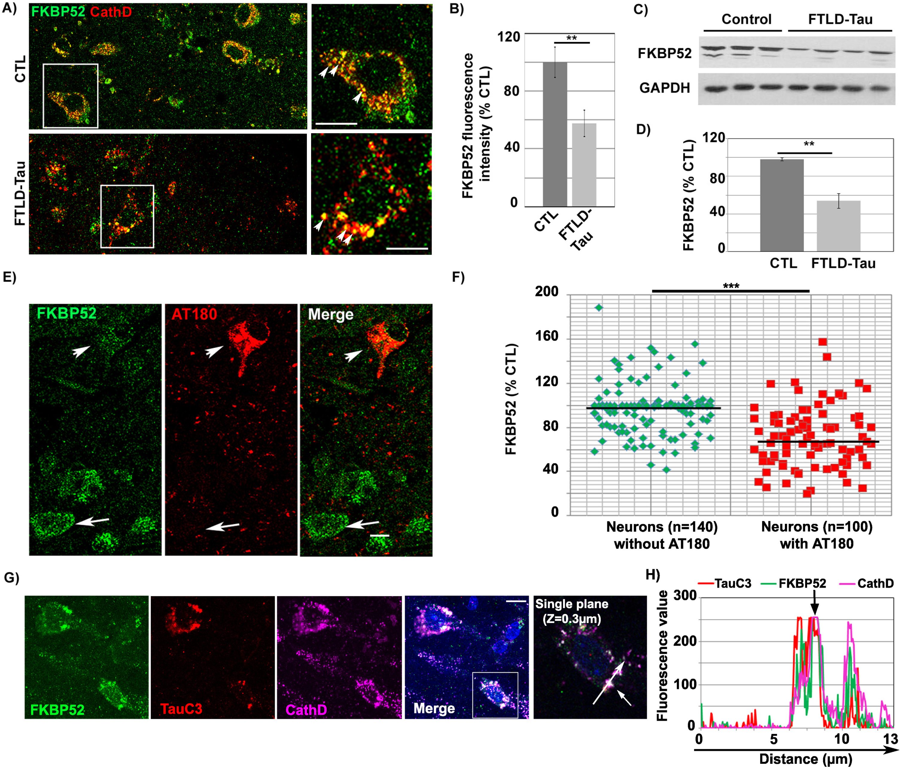 FKBP52 partially colocalizes with tau in the lysosomes and is decreased in NFTs-bearing neurons of familial FTLD-Tau patients. A) Double labeling Immunofluorescence: The FKBP52 signal (green) colocalizes with the Cathepsin D signal (red) of endosomal lysosomal vesicles in neurons of FTLD-Tau patients. Normal lysosomes in healthy neurons (size range: 0.2–0.5μm) and enlarged lysosomes in AD neurons (size range: 1.5–3μm) are indicated by arrowheads (see magnification, Scale bar 10μm). B) Fluorescent levels of neuronal FKBP52 in familial FTLD-Tau neurons quantified by image analysis are significantly decreased compared with neurons in the frontal cortex of age matched controls. Statistical analysis was performed using Student’s t-test, n = 4; **p < 0.01;±SEM. C) Total frontal cortex homogenates of familial FTLD-Tau patients analyzed by western blot and immunoblotted with EC1 (FKBP52) and 6C5 (GAPDH) antibodies. D) FKBP52 quantification in total brain homogenates (FKBP52/GAPDH) in controls and familial FTLD-Tau patients. Student’s t-test, n = 4; **p < 0.01;±SEM. E) Double labeling of a frontal cortex section from a familial FTLD-Tau patient showing a visibly decreased FKBP52 expression (green, arrow and arrowhead) in neurons with AT180 deposits (red, arrowhead) but not in adjacent neurons without visible AT180 labeling (arrows). F) Scatter diagrams of image analysis results of frontal cortex samples from four familial FTLD-Tau patients showing a significant decrease of FKBP52 in neurons exhibiting AT180 deposits compared to neurons without apparent AT180 deposition. Student’s t-test, n = 4; ***p < 0.001;±SEM. G) Triple labeling of a single Z-stack plane (0.3μm) showing the colocalization of the FKBP52 signal (green) with the caspase-cleaved Tau-D421 (TauC3, red) and the lysosomal Cathepsin D (magenta) signals in familial FTLD-Tau brain neurons. H) Fluorescence profiles of FKBP52, TauC3, and Cathepsin D antibodies showing the colocalization of the three signals on a single plane. Scale bar 10μm.