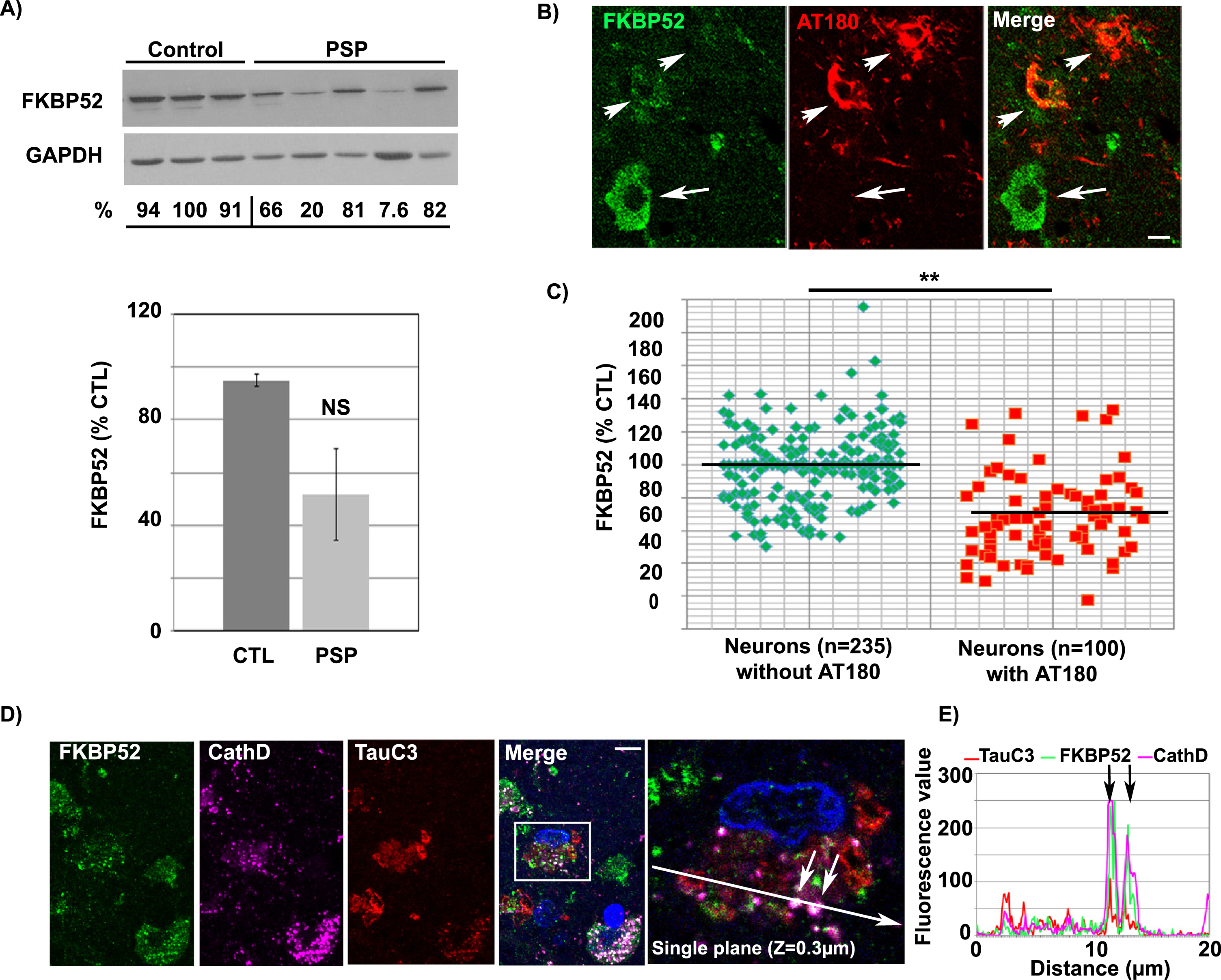 Decreased expression of FKBP52 in the frontal cortex of PSP patients: FKBP52 decrease in neurons with pathologic tau deposits is not limited to a specific tauopathy. A) Representative western blot analysis of PSP frontal cortex homogenates showing a non-significant decrease of FKBP52 (lower half), probably due to the strong heterogeneity of the neuronal pathology in the frontal cortex of PSP patients [42, 43]. B) Double labeling experiment on the frontal cortex section of a PSP patient. FKBP52 (green) expression in neurons with AT180 deposits (red, arrowheads) is visibly decreased (merge) in comparison to neurons without visible AT180 labeling (arrows). C) Scatter diagrams of cell by cell image analysis of neurons with and without AT180 deposits showing a significantly lower FKBP52 expression in cells exhibiting AT180 NFTs. Statistical analysis was performed using Student’s t-test, n = 5; **p < 0.01;±SEM. D) Triple labeling experiment on a frontal cortex section from a PSP patient showing FKBP52 (green), TauC3 (red) and Cathepsin D (magenta) colocalization (merge). E) The single Z-stack plane (0.3μm) fluorescence profiles of a neuron show the superposition of the three signals (arrows on image and fluorescence profiles). Scale bar 10μm.