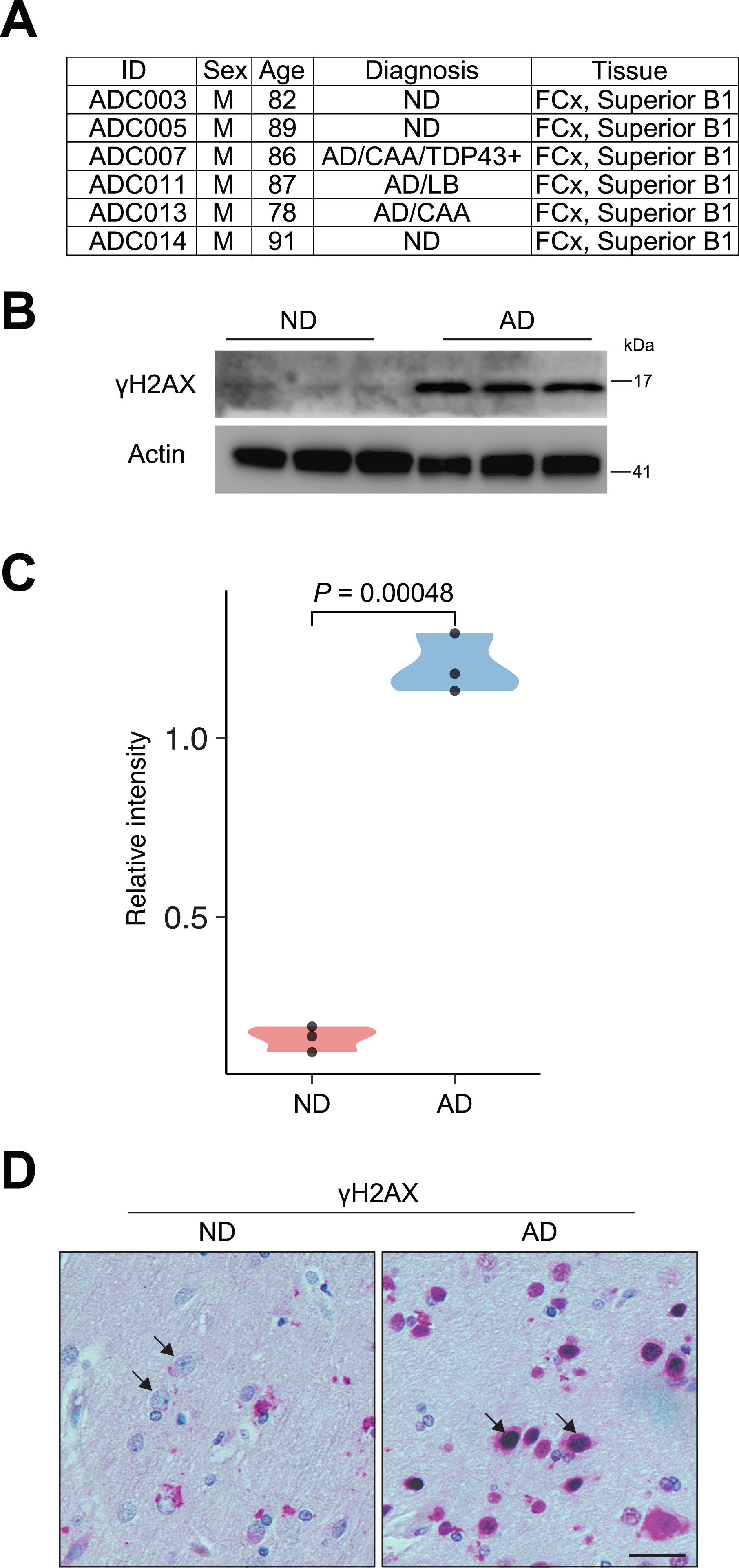 γH2AX signal reveals accumulation of DSBs in AD brain. A) Detailed information of the human cortex from postmortem human patients with AD and ND is included. B) Representative immunoblots of γH2AX expression in the human brain slides from ND and AD individuals. C) Quantification immunoblots of γH2AX expression relative to Actin in the human brain slides from ND and AD individuals. D) Images of immunostaining of γH2AX in frontal cortex slides from ND and AD individuals. Arrows indicate neurons. Scale bars, 10μm.