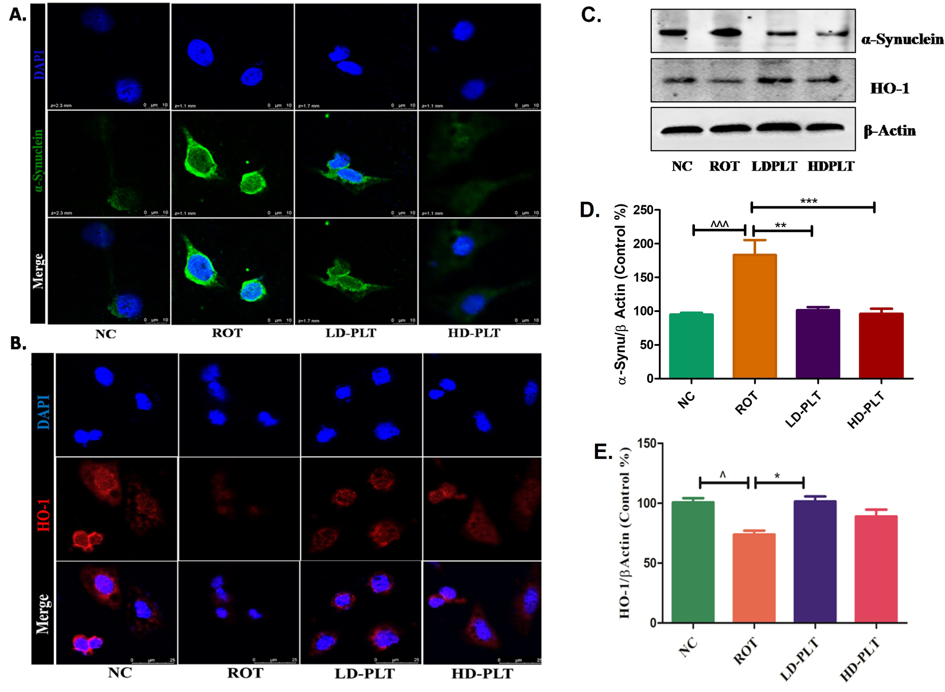 Effect of PLT exposure on antioxidant mechanism in ROT-exposed SH-SY5Y cells. Representative IF images of SH-SY5Y cells labeled with A) α-Synuclein, B) HO-1. C) The protein expression of α-Synuclein and HO-1 in PLT and ROT exposed SH-SY5Ycells by western blotting. Quantitative analysis of D) α-Synuclein and E) HO-1 using Image J software. The results obtained are represented as mean±SEM (n = 3). ***p < 0.001, **p < 0.01 and *p < 0.05 versus ROT.