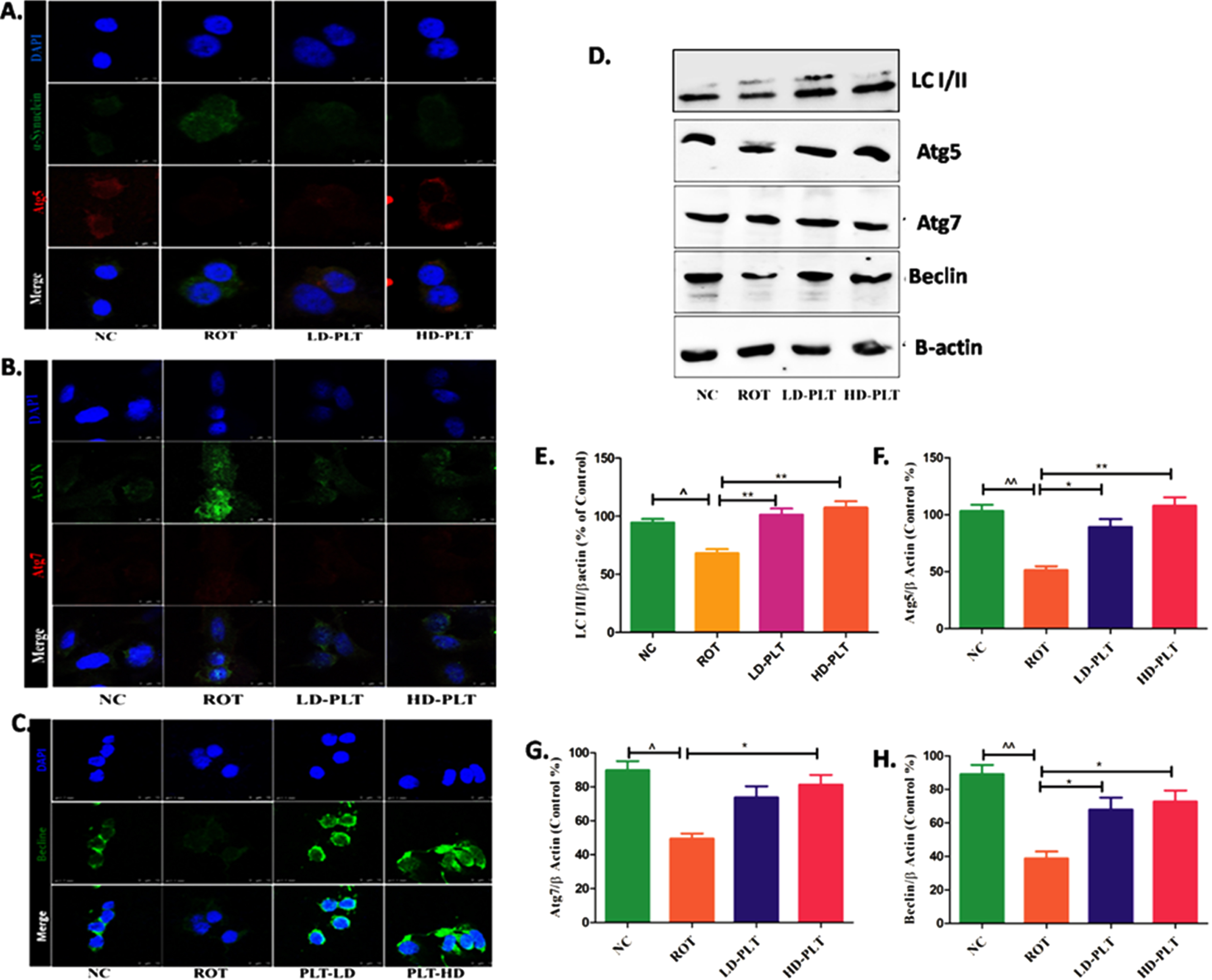Effect of PLT exposure on autophagic proteins in ROT-exposed SH-SY5Y cells. Representative IF images of SH-SY5Y cells labeled with A) Atg-5, B) Atg-7, C) Beclin. D) Western blot image of LC3B-I/II, Atg-5, Atg-7, and Beclin in PLT and ROT exposed SH-SY5Ycells by western blotting. Quantitative densitometric analysis of E) LC3B I/II, F) Atg-5, G) Atg-7, and H) Beclin using Image J software. The results obtained are represented as mean±SEM (n = 3). ***p < 0.001, **p < 0.01 and *p < 0.05 versus ROT, ∧∧p < 0.01 and ∧p < 0.05 versus ROT.
