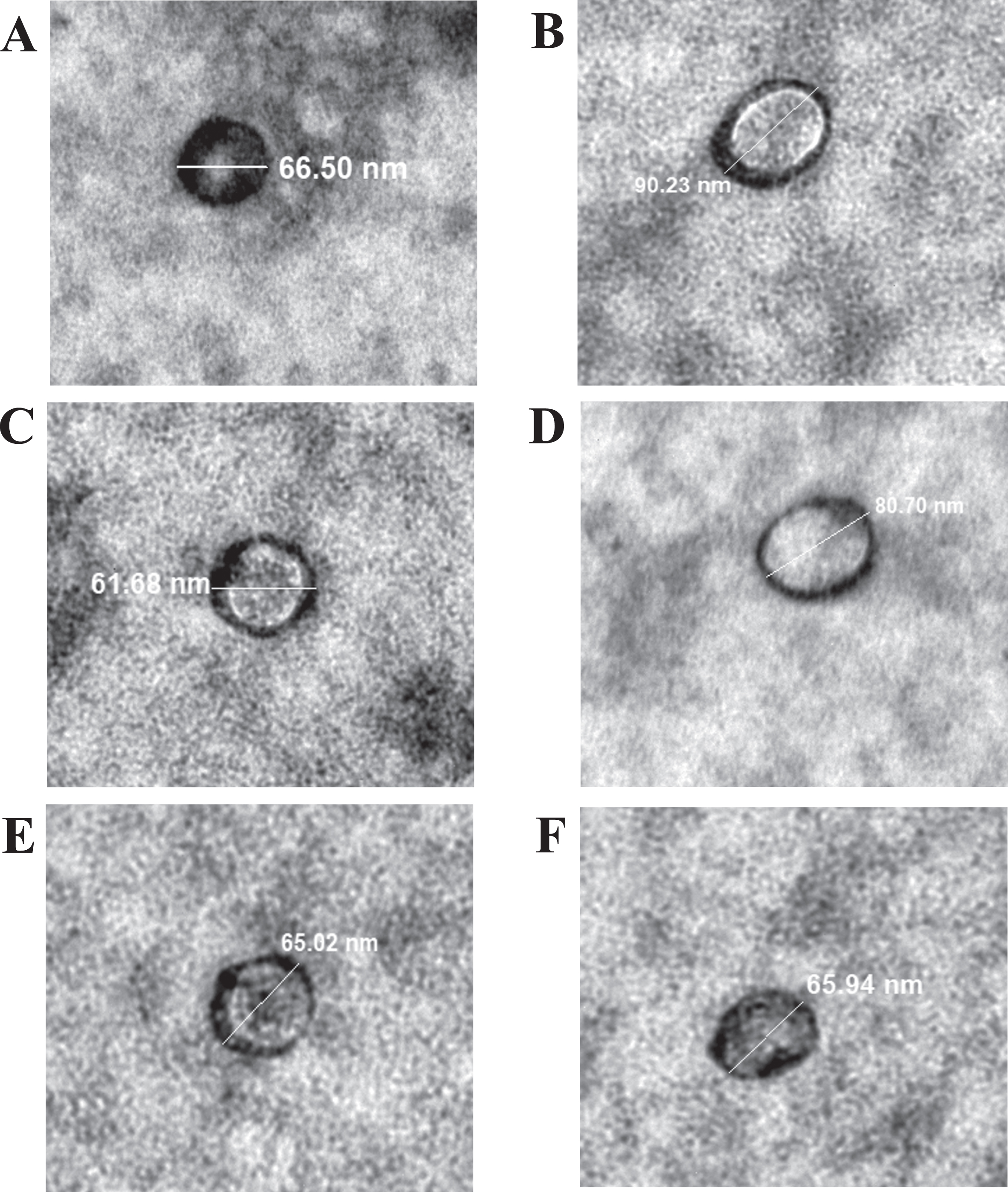 Electron micrographs of plasma exosomes. Representative images of samples from two independent subjects in each group are shown. Panel A and B correspond to exosomes from healthy controls; Panel C and D represent exosomes purified from AD subjects; exosomes fractionated from plasma samples of frontotemporal dementia subjects are shown in panel E and F. [Magnification = x15000].