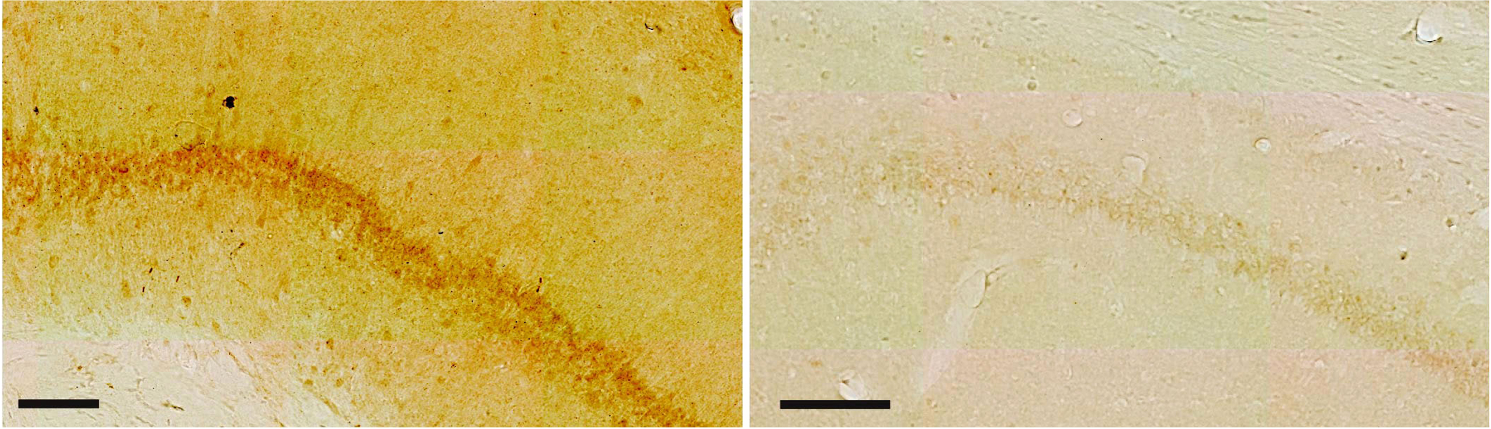 The Aβ42 antibody is specific: (left image) Immunolabeling with the IBL Aβ42 antibody reveals a high level of signal in CA1 of three-month-old Wistar rats, while (right image) practically no signal is present in CA1 of 6-month-old APP-Knockout mice (same results were obtained for 12-month-old APP-Knockout mice). Scale bars = 100μm. Images were acquired using identical settings.