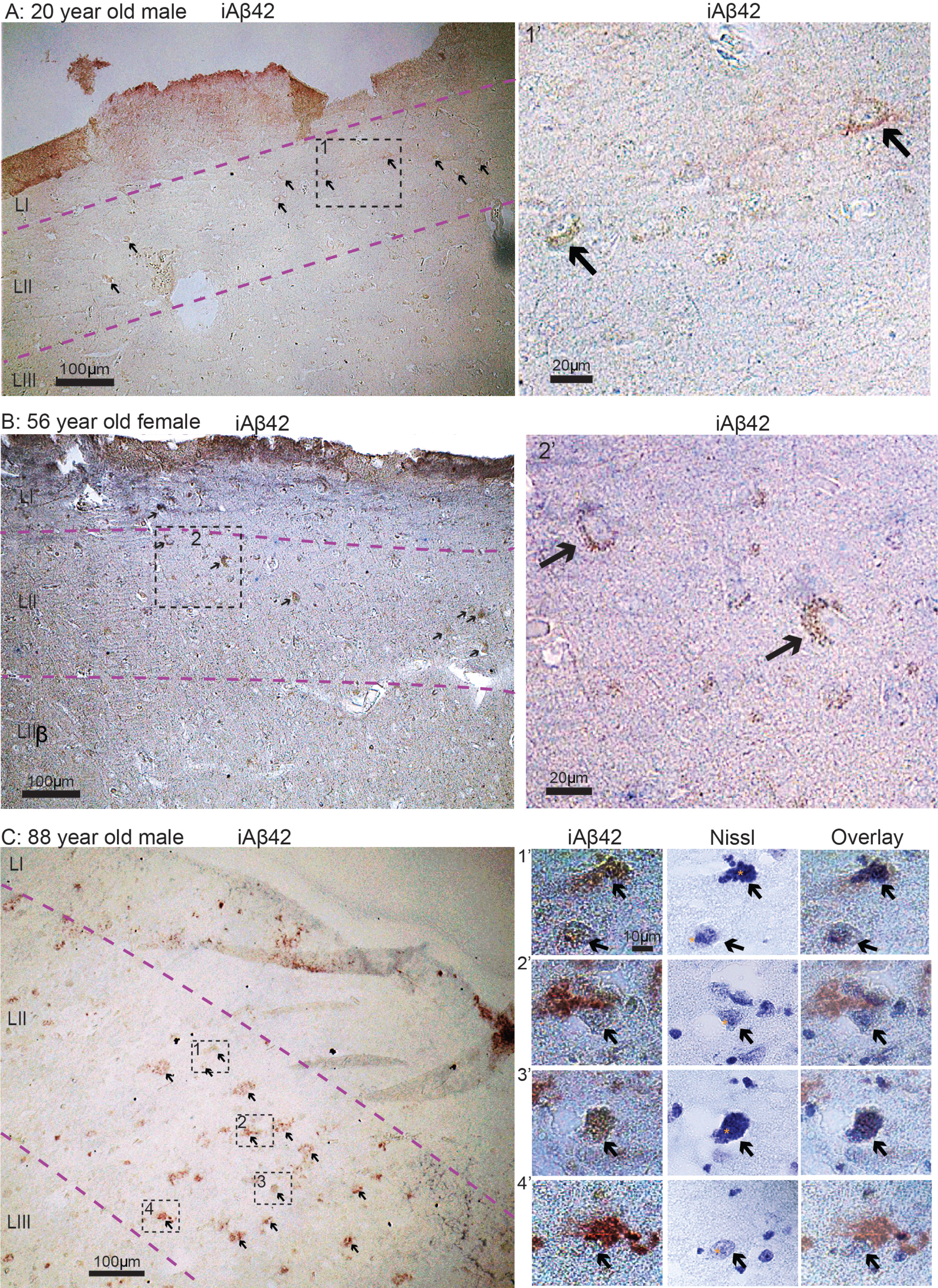 iAβ42 is present in entorhinal cortex layer II neurons in human subjects free of neurological disease. A) 20-year-old male. B) 56-year-old female. C) 88-year-old male. Overview images in (A-C) were taken with a 10x objective, insets for (A) and (B) were taken with a 20x objective, while insets for (C) were taken with a 100x oil immersion objective. Immunolabelling and Nissl staining is indicated for each image/panel. Stippled lines in light magenta indicate layers. To indicate nucleoli in the middle panels of (C), we have placed a small asterisk immediately to the left of each. Scale bars are indicated for each image/panel (in (C), the scale bar in top left image applies to all in this panel).