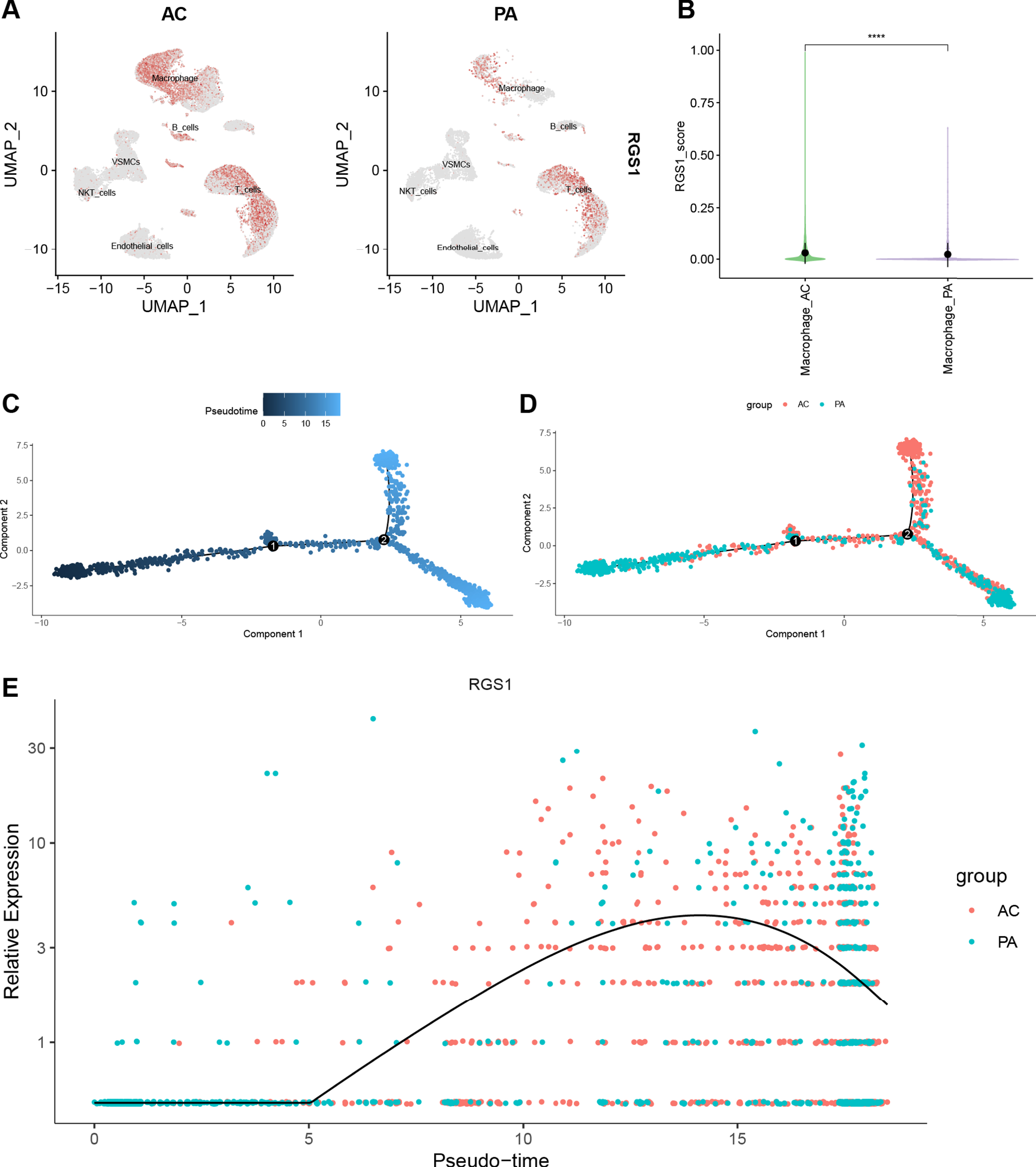 A) Feature plot shows the expression of RGS1 in different cell clusters of CA. The ochre dots indicate the expression of RGS1 in this cell cluster. B) There was a difference in the expression of RGS1 in macrophages in the two groups, and the difference was statistically significant. ****p < 0.0001. C–E) Pseudotime analysis of macrophages in GSE159677. C) Timing differences in cell differentiation. Darker blue represents an earlier stage of differentiation, while lighter blue indicates a later stage of differentiation. D) Differentiation of AC macrophages from PA macrophages. E) Timing differences in the expression of RGS1 in different groups. It was upregulated in the AC group and downregulated over time in the PA group. CA, carotid atherosclerosis; AC, atherosclerotic core; PA, proximal adjacent.