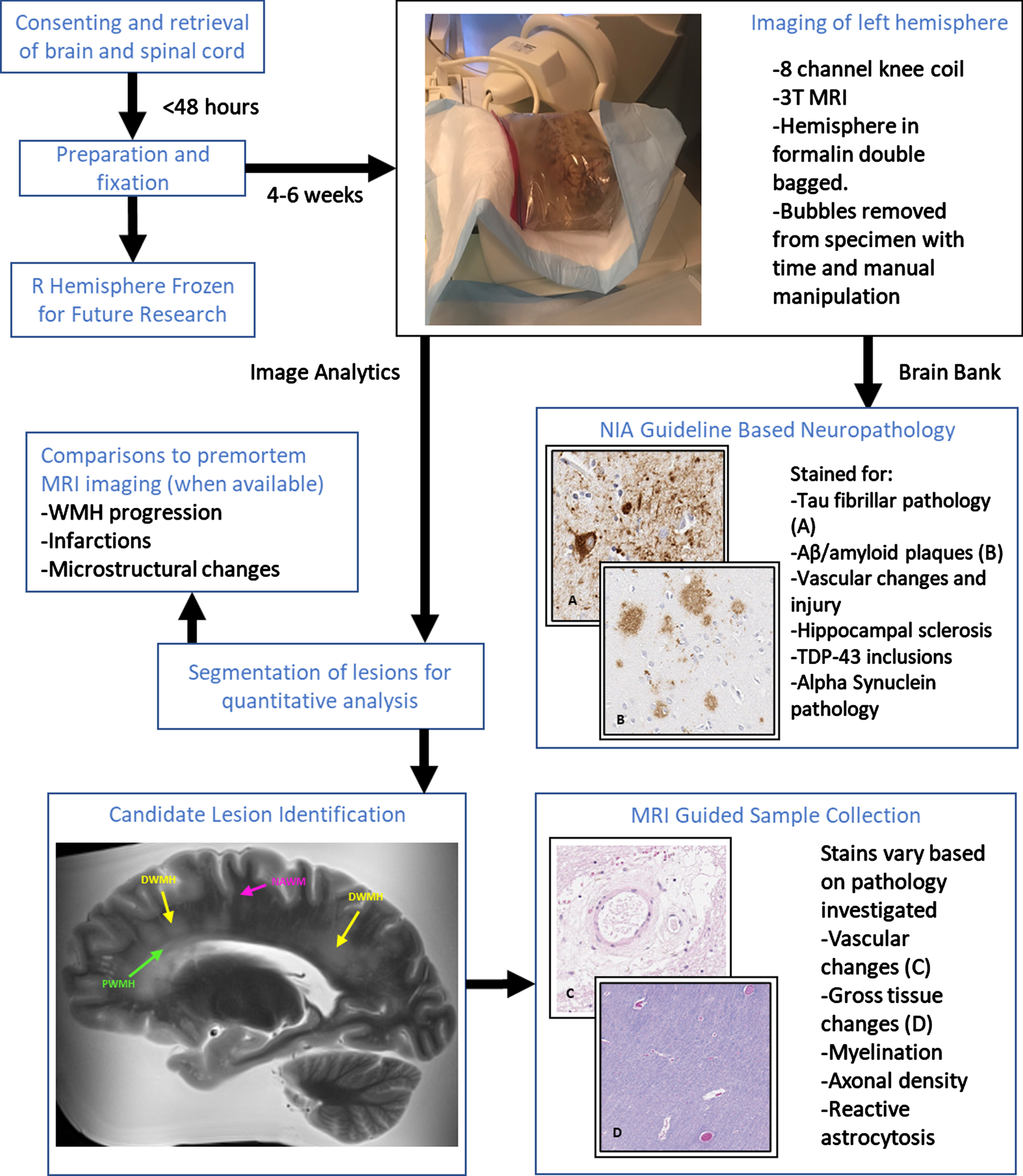 Overview of MR-guided histopathological examination within the South Texas Alzheimer’s Disease Research Center Repository. Perivascular (green), deep (yellow), and normal appearing (magenta) white matter examples are identified in the MRI image.