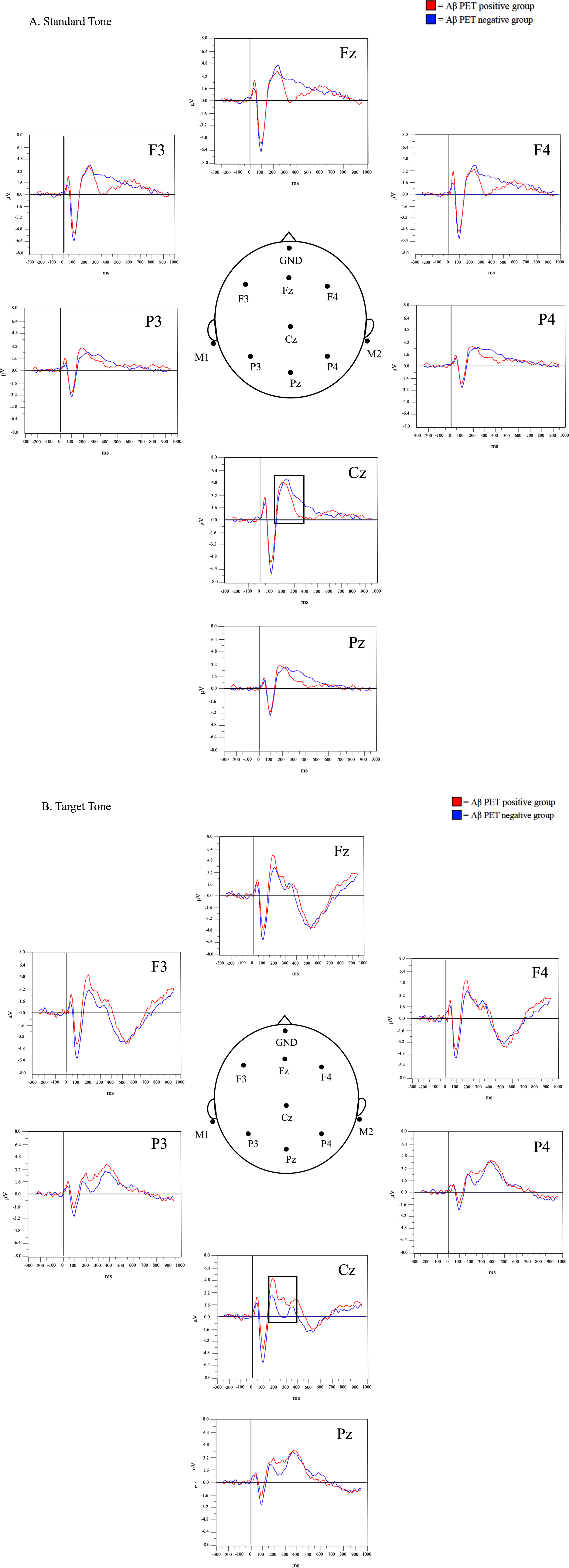 Grand-average waveforms at the standard (A) and target (B) tones.