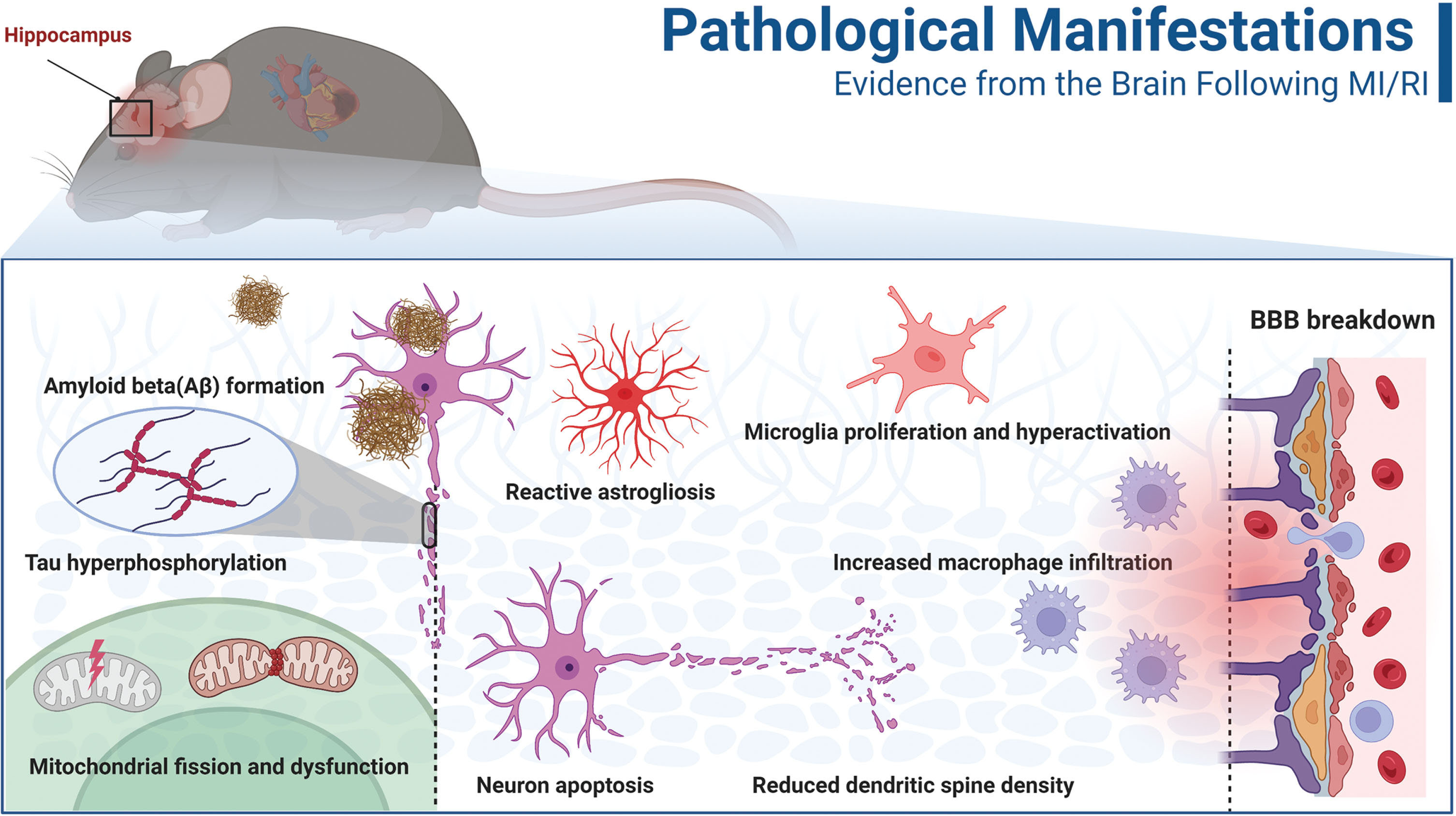 Pathological manifestations of the brain after MI/RI. At the subcellular level, mitochondrial fusion and mitochondrial dysfunction, amyloid-β (Aβ) formation and tau hyperphosphorylation occur after MI/RI (left part of the figure). At the cellular level, astrocyte activation, microglia activation, overproliferation, neuronal apoptosis combined with dendritic spine damage, and increased macrophage infiltration were observed after MI/R I (middle of the figure). At the tissue level (right part of the figure), MI/RI caused damage to the blood-brain barrier (BBB). MI/RI, Myocardial ischemia/reperfusion injury.