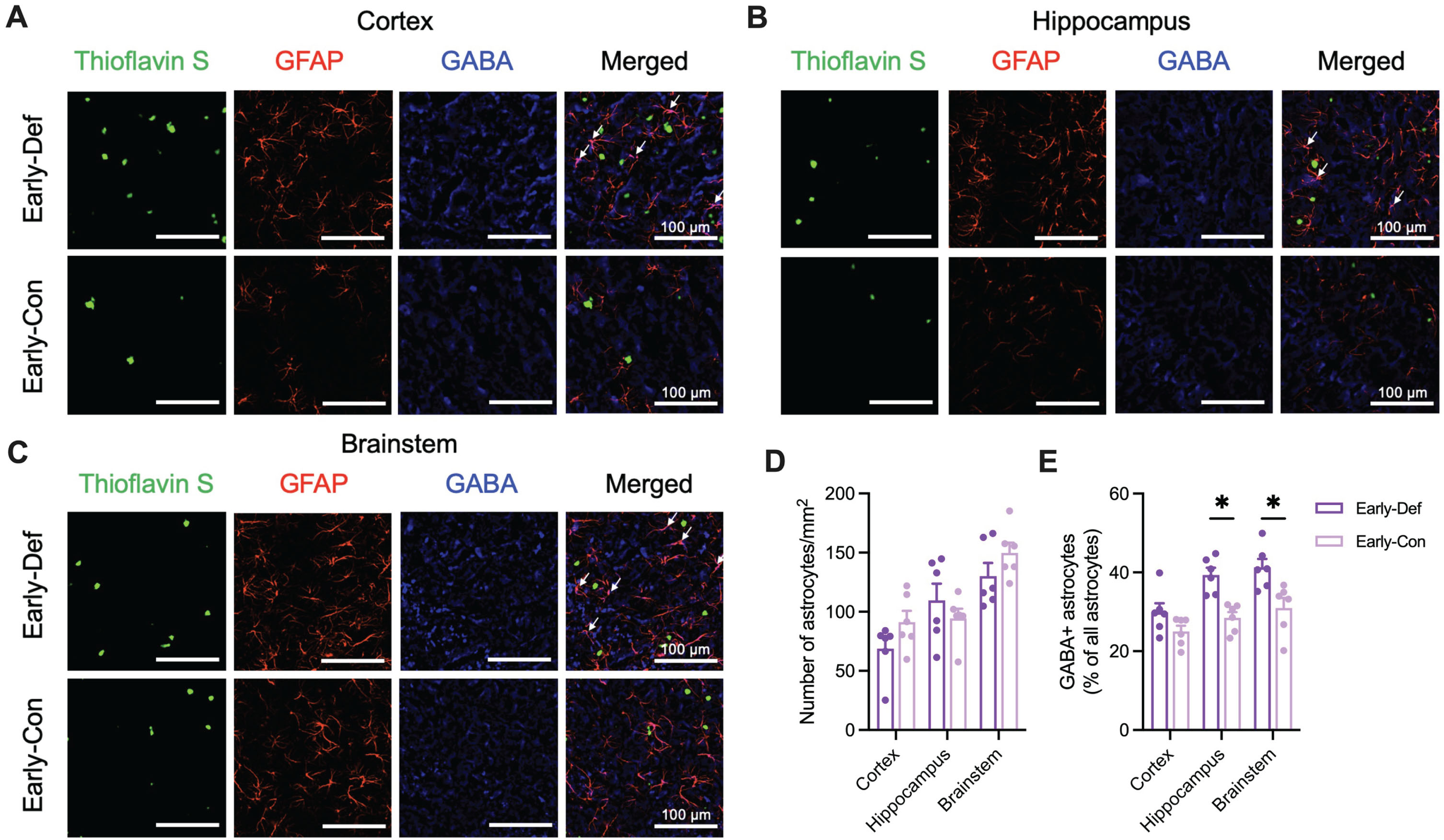 Vitamin D deficiency showed increased GABA-positive reactive astrocytes in the early phase of 5XFAD mice. A) Representative image of cortical Aβ plaques (Thioflavin S; Green), astrocytes (GFAP; Red), and GABA (Blue) in the primary motor cortex (Scale bar, 100μm) of Early-Def and Early-Def groups. There is colocalization between GFAP and GABA (white arrows). B) Representative images of Aβ plaques, astrocytes, and GABA in the hippocampus of two groups. There is colocalization between GFAP and GABA (white arrows). C) Representative images of Aβ plaques, astrocytes, and GABA in the nucleus tractus solitarius of two groups. There is colocalization between GFAP and GABA (white arrows). D) The number of astrocytes (GFAP + cells) per unit area in the cortex, hippocampus, and brainstem. E) Colocalization of GABA-positive astrocytes in the cortex, hippocampus, and brainstem. Data are presented as mean±SEM. *p < 0.05 by Student’s t-test or Mann-Whitney test. Aβ, amyloid-β; GFAP, glial fibrillary acidic protein; GABA, gamma-aminobutyric acid.