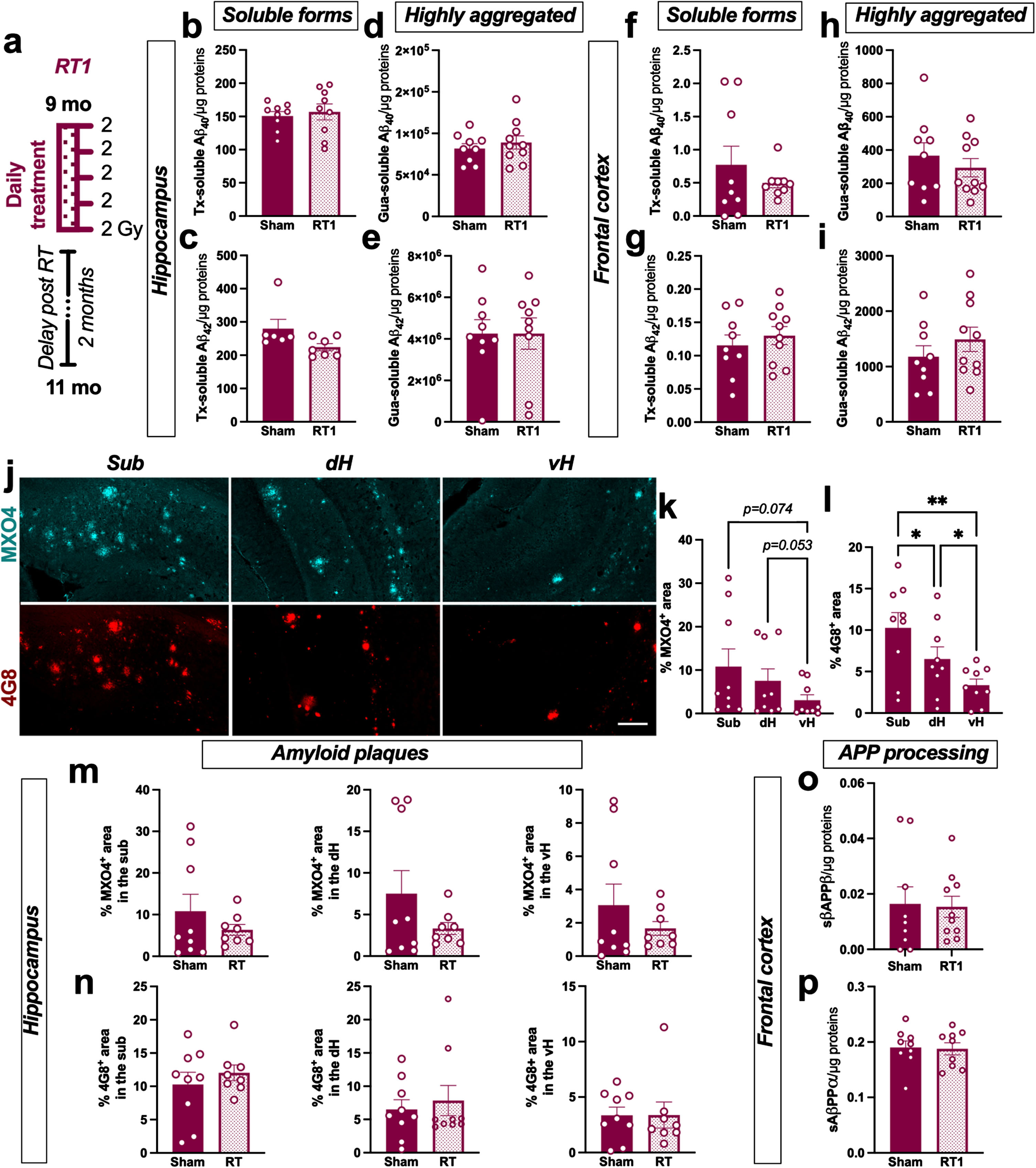 LD-RT does not reduce amyloid load in early AD females. a) Female TgF344-AD were bilaterally treated by X-ray radiation (2 Gy×5 fractions delivered daily; RT1) at 9-month-old, modeling an early AD stage, and analyzed 2 months later. Sham-treated TgAD rats and WT were only anesthetized. Concentration of Aβ40 (b) and Aβ42 (c) measured in the triton (Tx) soluble fraction of the hippocampus by ELISA. Concentration of Aβ40 (d) and Aβ42 (e) measured in Gua-soluble fraction of the hippocampus by ELISA. (f–i) Concentration of the different Aβ peptides in the frontal cortex by ELISA. (j) Representative images of amyloid plaques labelled with Methoxy-XO4 (MXO4; blue) or 4G8 antibody (red) in hippocampal subregions in a sham treated TgAD rat. Scale bar = 150 μm. Distribution of MXO4+ (k) and 4G8+ (l) plaques in the hippocampal subregions (Sub, subiculum; dH, dorsal hippocampus; vH, ventral hippocampus) in sham animals. Quantification of MXO4+ (m) and 4G8+ (n) plaques in the different hippocampal subregions in sham and RT1-treated rats. Concentration of sAβPPβ (o) and sAβPPα (p) in the Tx-soluble fraction of the frontal cortex measured by ELISA. Unpaired t-test or One-way ANOVA and Tukey’s multiple comparisons test. *p < 0.005, **p < 0.01.