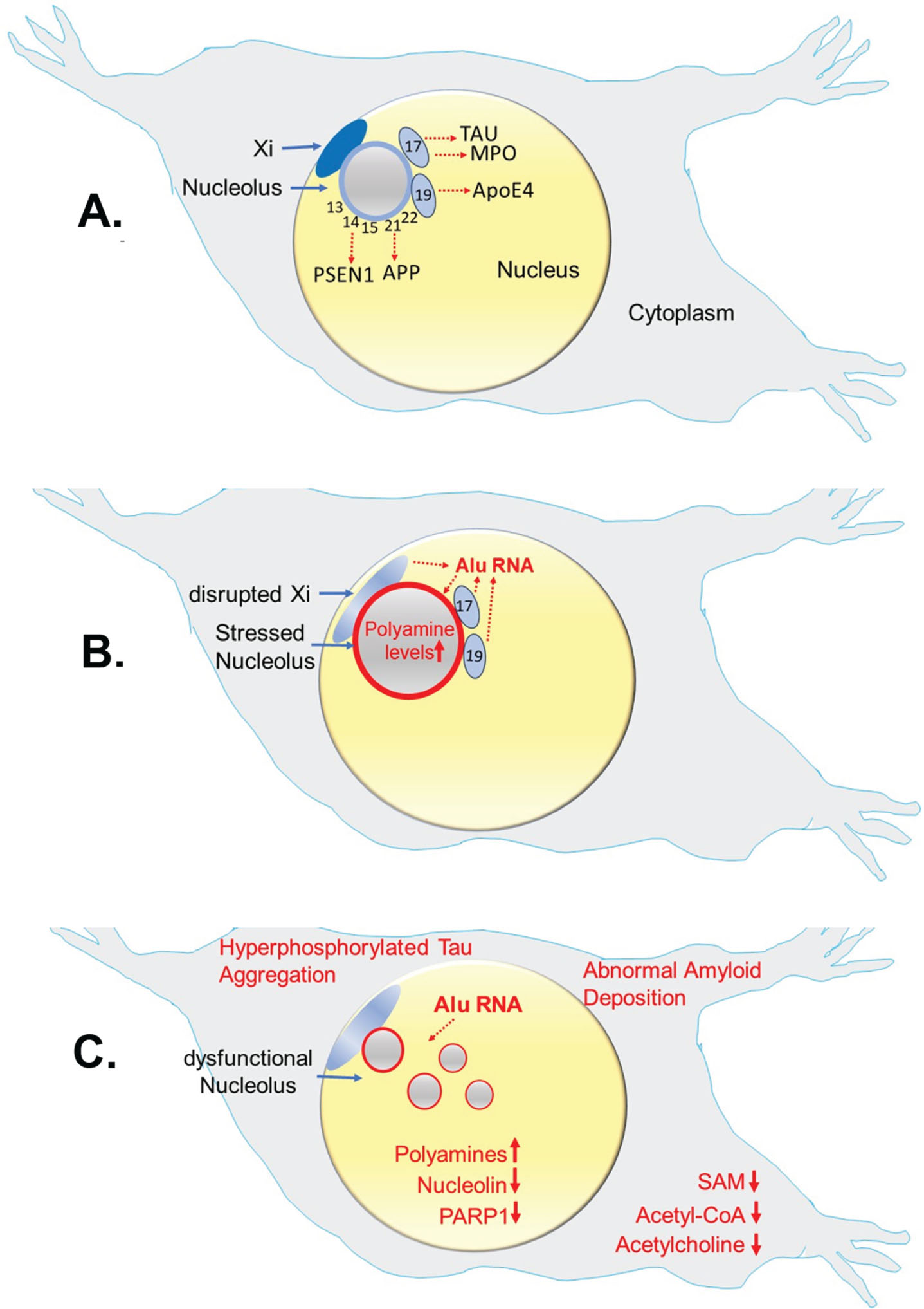 Alzheimer’s Scenario. This scenario improves on the “X chromosome-nucleolus nexus” hypothesis by providing additional insights based on Alzheimer’s research. It could also be called the “polyamine dysregulation and nucleolar disruption” hypothesis, or simply the “polyamine” hypothesis. This hypothesis potentially has relevance in multiple autoimmune diseases. A) Chromosomes (13, 14, 15, 21, 22) containing nucleolar organizing regions (NORs) are part of the nucleolar heterochromatic shell and contain genes of importance in AD: presenilin-1 (PSEN1) on chromosome 14 and amyloid precursor protein (APP) on chromosome 21. Other chromosomes of interest are chromosome 17 with the tau (TAU) gene and the myoperoxidase (MPO) gene, and chromosome 19 with the ApoE4 allele. Chromosomes 17 and 19 can localize near the nucleolus since they contain genes involved in DNA repair, a function of the nucleolus. B) Stress can increase polyamine levels causing nucleolar expansion, potentially disrupting neighboring chromosomes (e.g., Xi, 17, 19). Chromatin disruption can open previously sequestered sequences, such as Alu elements, which comprise 11% of the genome. Xi PAR1 is ∼29% Alu, 17p13.3 in chromosome 17 is 30% Alu, and all of chromosome 19 is 25.8% Alu. C) An abundance of RNA pol III enzyme typically found near nucleoli can express “free” Alu transcripts that compete with RNA pol II transcribed structural RNAs (containing intronic Alu sequences) bound to nucleolin, thereby disrupting the nucleolar heterochromatic shell. As a result, nucleoli lose their integrity with leaking and even fragmentation. SAT1 transcripts, previously sequestered by nucleolin, increase polyamine recycling which reduces acetyl-CoA (impacting acetylcholine levels) and generates putrescine further increasing polyamine synthesis (impacting SAM levels). Low SAM levels can induce p38 kinase phosphorylation of Tau, which can aggregate when bound by released nucleolar polyamines. Nucleolar poly [ADP-ribose] polymerase 1 (PARP1) levels drop as PARP1 binds exposed DNA damage and an abundance of RNA.