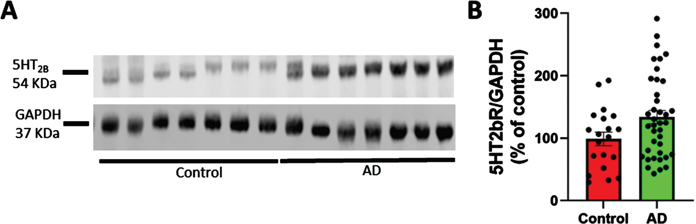 5HT2bR expression in cortex from postmortem AD specimens. 5HT2bR expression is increased in cortex from post-mortem specimens from AD patients (39 sporadic AD: 22 females and 17 males) and age-matched non-demented controls (20 individuals: 7 females and 13 males). Postmortem interval was recorded. Individuals were characterized for their Braak and Braak stage (VI-0), and CERAD score (C-0). AD patients had no other diseases that might have contributed to the clinical deficits. A) Representative western blotting of 5HT2bR level in human brain samples. B) Cumulative graphs (t-test p = 0.039).