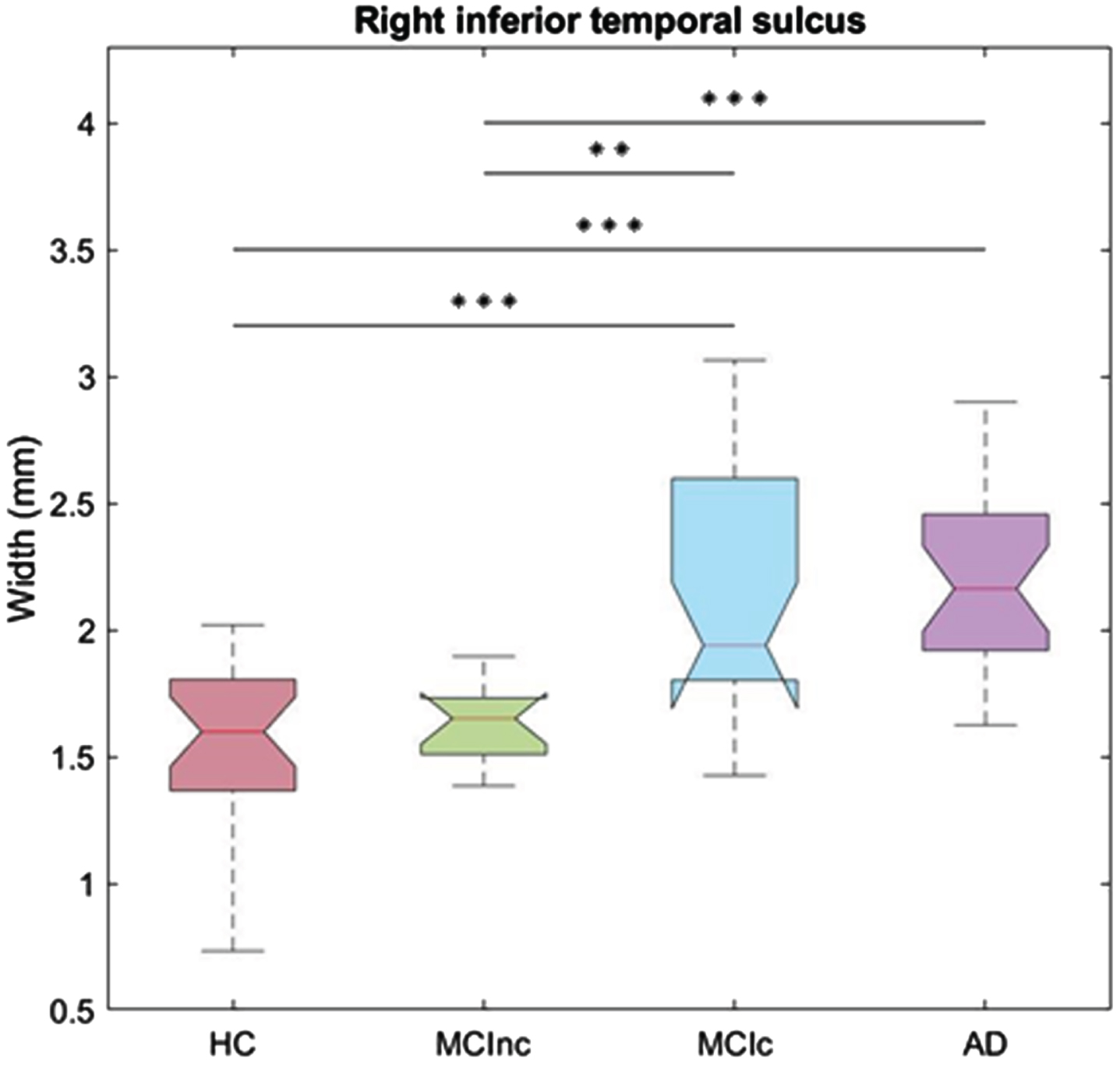 Boxplot of the width of the right inferior temporal sulcus across the four groups. The feature evidently differentiates HC and MCI nc from AD and MCIc. **p < 0.01; ***p < 0.001. HC, healthy controls; MCInc, non-converter MCI; MCIc, converter MCI; AD, Alzheimer’s disease.
