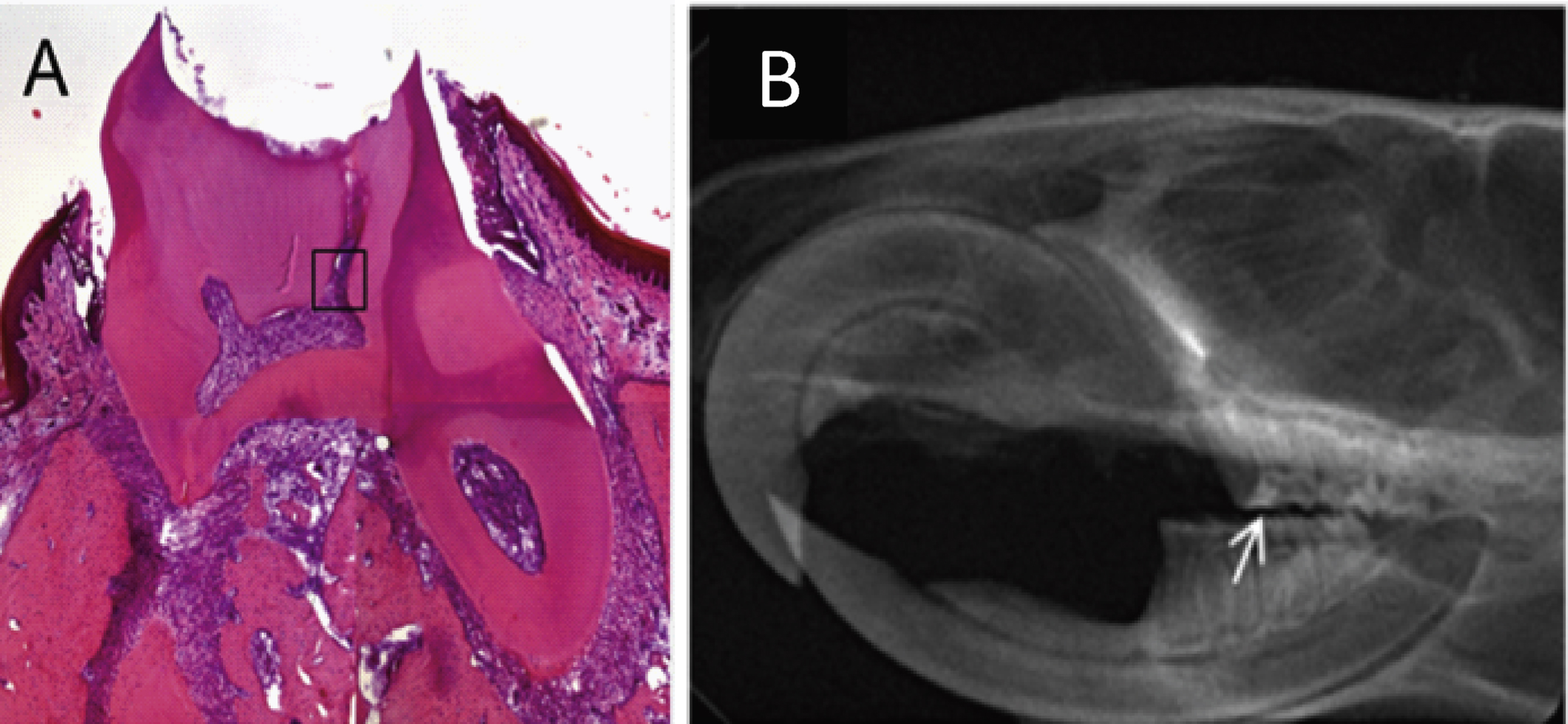 First molar of an adult rat three weeks after human dental stem cell implantation into the prepared pulp cavity: (A) HE-staining of a cross section from the molar showing the access cavity into the pulp chamber with inserted resin filling (see region of interest); (B) x-ray of the lower and upper jaw, lateral view; arrow shows position of the resin filling of the first molar.