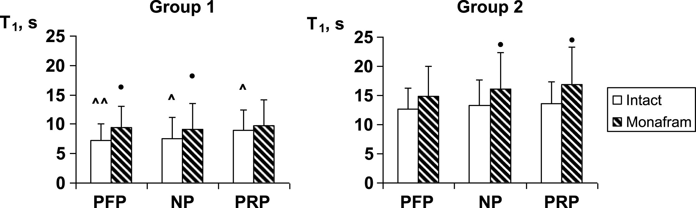 Influence of monafram on characteristic time of early RBC aggregation (T1) in platelet-free plasma (PFP), native plasma (NP), and platelet rich plasma (PRP) of healthy volunteers with “hyperaggregation” (Group 1, n = 6) and normal aggregation (Group 2, n = 12). Difference from intact samples, •p < 0.05 and difference from Group 2, ∧p < 0.05, ∧∧p < 0.01.