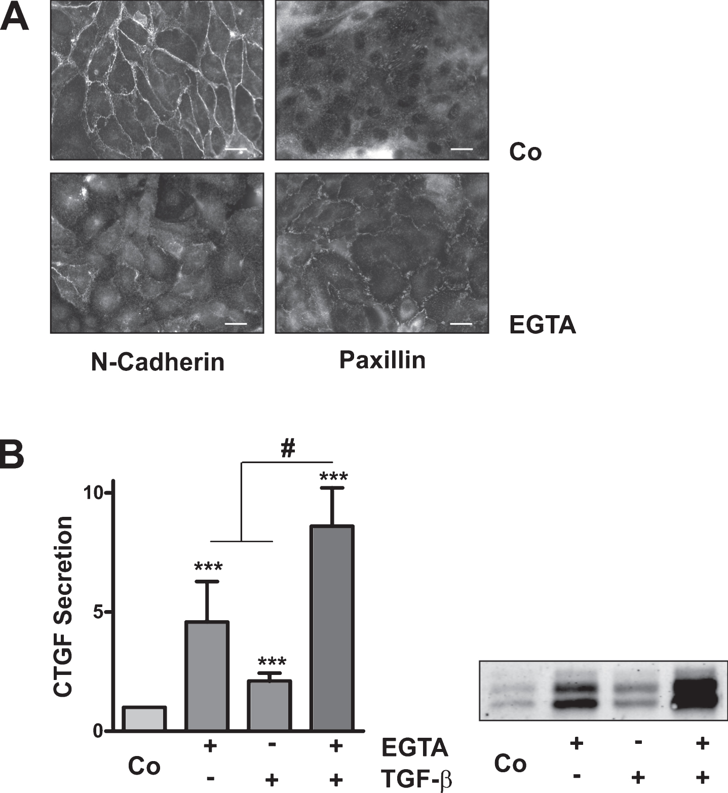 Synergistic induction of CTGF by EGTA and TGFβ-1 in primary human tubular cells. (A) Primary tubular cells were treated with EGTA (1 mM) for 2 h. N-cadherin and paxillin were detected by indirect immunofluorescence. Scale bars: 20μm. (B) Cultures of primary tubular cells obtained from 3 different donors were pre-treated with EGTA (1 mM) for 30 min and were then stimulated with TGF-β for 6 h. CTGF was detected in the cell culture supernatants by Western blotting. Intensity of CTGF secreted by control cells was set to 1 on each blot. Data are means±SD of 5 independent experiments. *p > 0.05, ***p < 0.001 vs control cells, ANOVA with Bonferroni post hoc-test; #p < 0.05, paired t-test, sum of EGTA plus TGFβ-1 vs combined stimulation.