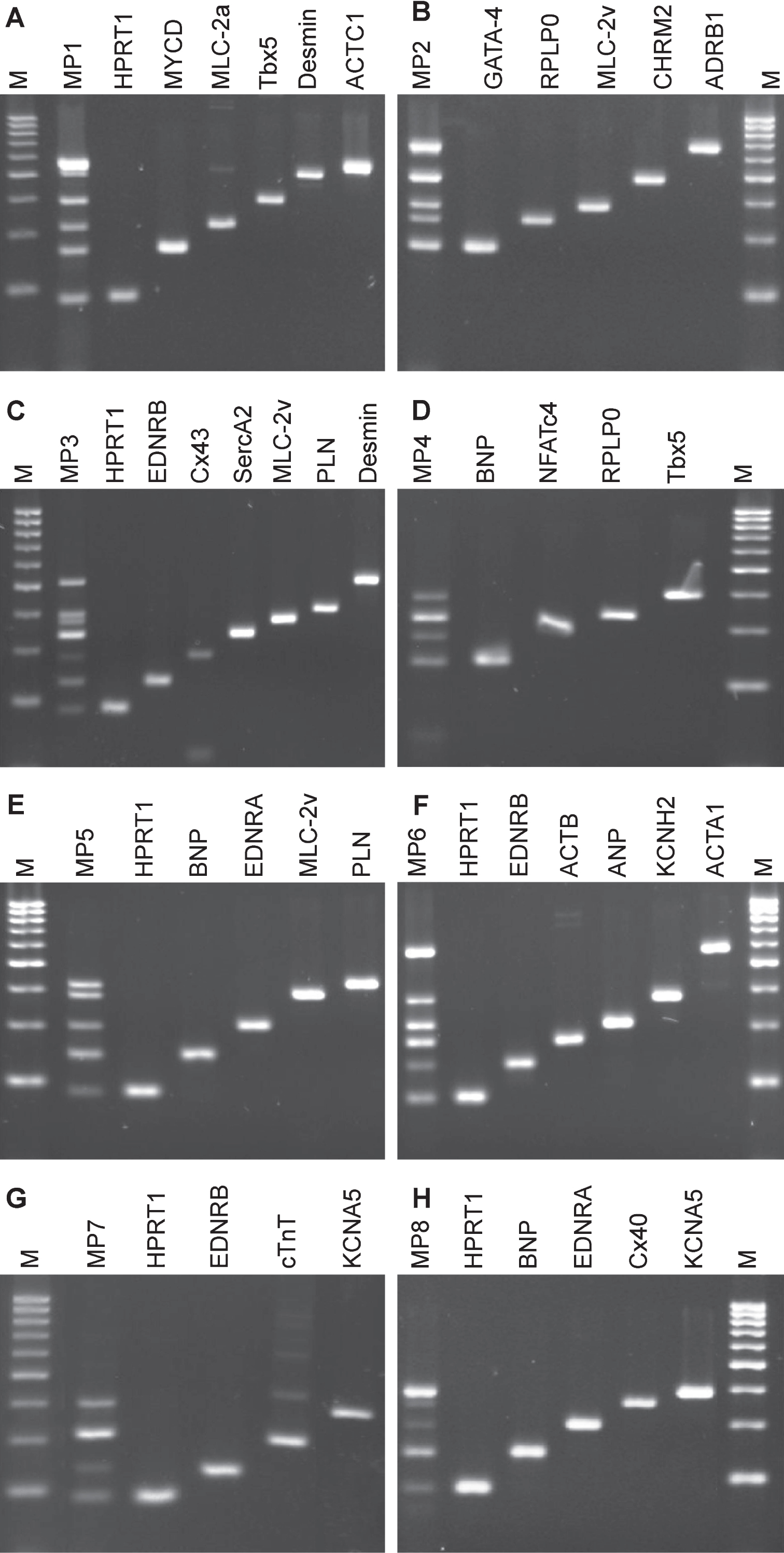 Agarose gel electrophoresis analysis of multiplex PCR on cDNA from ventricular heart muscle tissue. Total RNA of ventricular tissue was prepared, and mRNA was processed into cDNA by reverse transcriptase. Eight combinations of primer pairs that included cardiomyocyte-specific marker or reference gene transcripts (HPRT1 or RPLP0) were set for multiplex PCR. Multiplex PCR amplicons were compared to single loci PCR, respectively. A) Multiplex PCR (MP1) approach amplifying six transcript cDNAs and single transcripts with increasing fragment sizes: HPRT1, MYCD, MLC-2a, Tbx5, DES and ACTC1; B) Multiplex PCR (MP2) approach amplifying five transcript cDNAs and single transcripts with increasing fragment sizes: GATA-4, RPLP0, MLC-2v, CHRM2 and ADRB1; C) Multiplex PCR (MP3) approach amplifying seven transcript cDNAs and single transcripts with increasing fragment sizes: HPRT1, EDNRB, Cx43, SERCA2, MLC-2v, PLN and DES; D) Multiplex PCR (MP4) approach amplifying four transcript cDNAs and single transcripts with increasing fragment sizes: BNP, NFATc4, RPLP0 and Tbx5; E) Multiplex PCR (MP5) approach amplifying five transcript cDNAs and single transcripts with increasing fragment sizes: HPRT1, BNP, EDNRA, MLC-2v and PLN; F) Multiplex PCR (MP6) approach amplifying six transcript cDNAs and single transcripts with increasing fragment sizes: HPRT1, EDNRB, ACTB, ANP, KCNH2 and ACTA1; G) Multiplex PCR (MP7) approach amplifying four transcript cDNAs and single transcripts with increasing fragment sizes: HPRT1, EDNRB, cTnT and KCNA5; H), Multiplex PCR (MP8) approach amplifying five transcript cDNAs and single transcripts with increasing fragment sizes: HPRT1, BNP, EDNRA, Cx40 and KCNA5. Amplicons were compared to 50 bp marker.