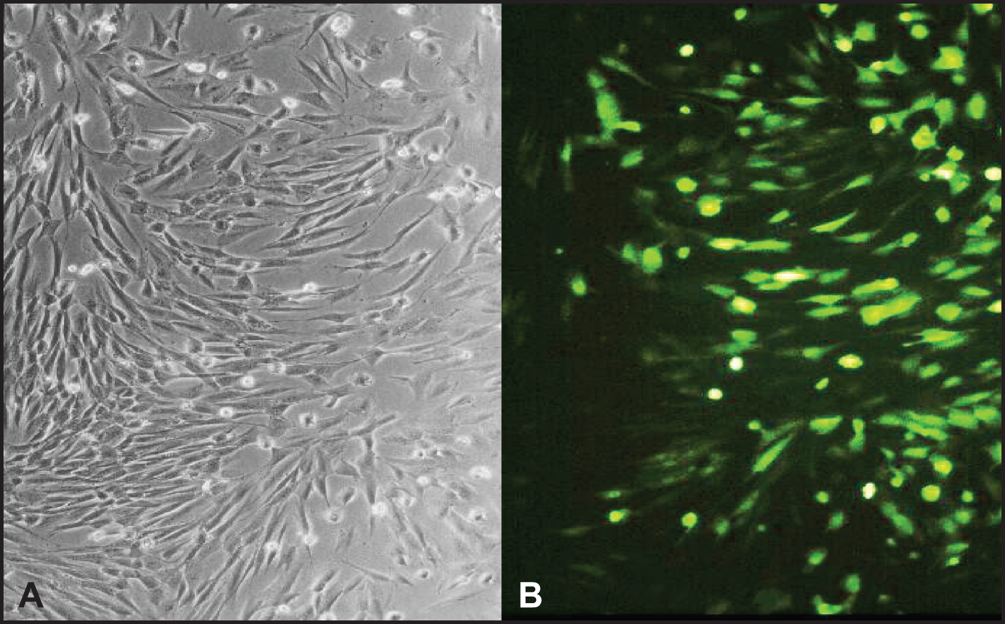 Normal human skin fibroblasts are efficiently transduced by the recombinant adenovirus. Primary fibroblast were transduced with rAdV-PARP-GFP (MOI = 25). GFP expression was analyzed by fluorescence microscopy 24 h after transduction. Cells successfully transduced expressed a GFP reporter (B). Phase contrast image of the same cells (A).