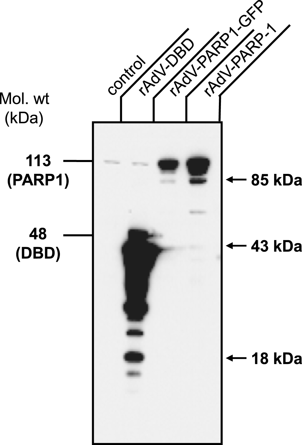 Transduced cells overexpress PARP1 and PARP1 DBD. Normal human fibroblast cells were transduced with rAdV-DBD, rAdV-PARP-GFP and rAdV-PARP (MOI = 25 each). Cell lysates were prepared 24 h after transduction and 1×105 cells were analyzed by western blot analysis using antibody C2-10 to detect PARP1 and DBD. Overexpression of PARP1 DBD and PARP1 of the expected sizes was observed at 45 kDa and 113 kDa, respectively. Apoptotic fragments (arrows) and proteolytic cleavage products of both PARP-1 DBD and PARP-1 were also detectable. Note the slightly lower expression levels obtained with rAd-PARP1-GFP as compared to rAd-PARP1.