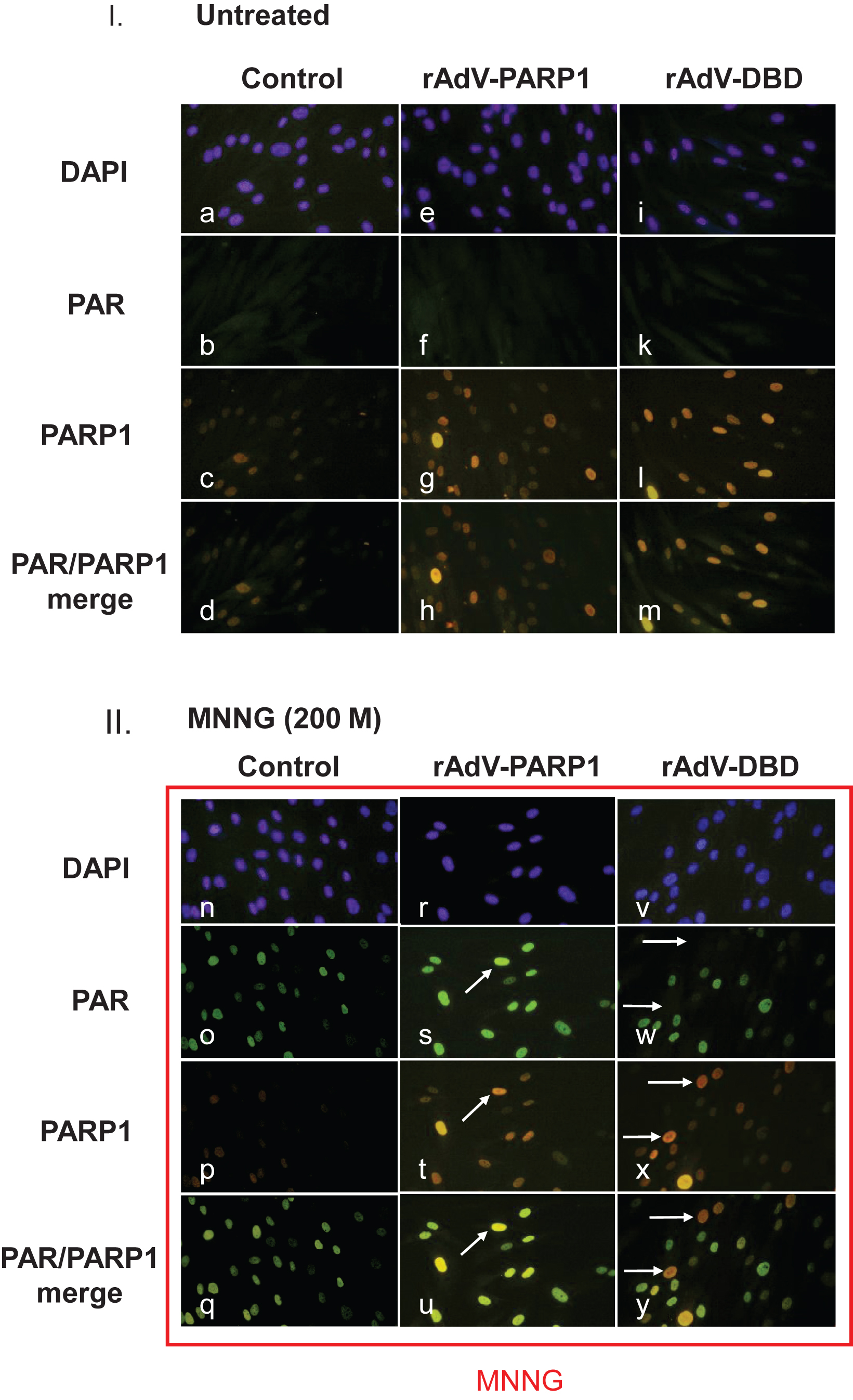 Poly(ADP-ribose) formation is altered in cells overexpressing PARP1 and PARP1 DBD. Normal human skin fibroblasts were transduced with rAdV-DBD and rAdV-PARP (MOI = 25 each). Twenty-four hours after transduction, cells were treated with 200μM MNNG for 20 min. Cells were washed with PBS, fixed with 4% formaldehyde and immunofluorescence staining was performed using a monoclonal antibody (10H) to detect poly(ADP-ribose) (PAR) and a polyclonal rabbit antiserum to detect PARP1. Secondary antibodies used were goat anti-mouse (fluorescein coupled (FITC, green) and goat anti-rabbit (rhodamine-coupled (TRITC, red). DNA was counterstained with DAPI. I. Fibroblast transduced with either rAdV-PARP or rAdV-DBD showed stronger nuclear PARP1 signals (g and l, respectively) than control cells (c). Without exogenously induced DNA damage, no increased PAR formation could be observed in control cells and in PARP1 and PARP1 DBD overexpressing cells (c, f, k). II. After MNNG induced DNA damage, control cells showed strong nuclear poly(ADP-ribose) signals (o). The PARP1 signal in these cells are very strong (p). Therefore the merge of PAR signals and PARP1 signals shows a green nuclear color (q). In cells overexpressing PARP1, the PAR signals (s) were stronger in cells which also showed a stronger PARP1 specific staining (compare arrows in s and t), indicating that a high expression level due to the transduction leads to an increase in PAR formation. In the merged image, these cells appear yellowish, while cells with lower PARP1 expression levels appear greenish (u). In cells which overexpressed the dominant negative DBD of PARP1, cells with strong PARP1 DBD signals (arrows in x) lacked PAR signals (arrows in w). In the merged image (y), these cells therefore appeared red (arrows), while cells without strong DBD signals appeared greenish due to the ADP-ribose polymer signals.